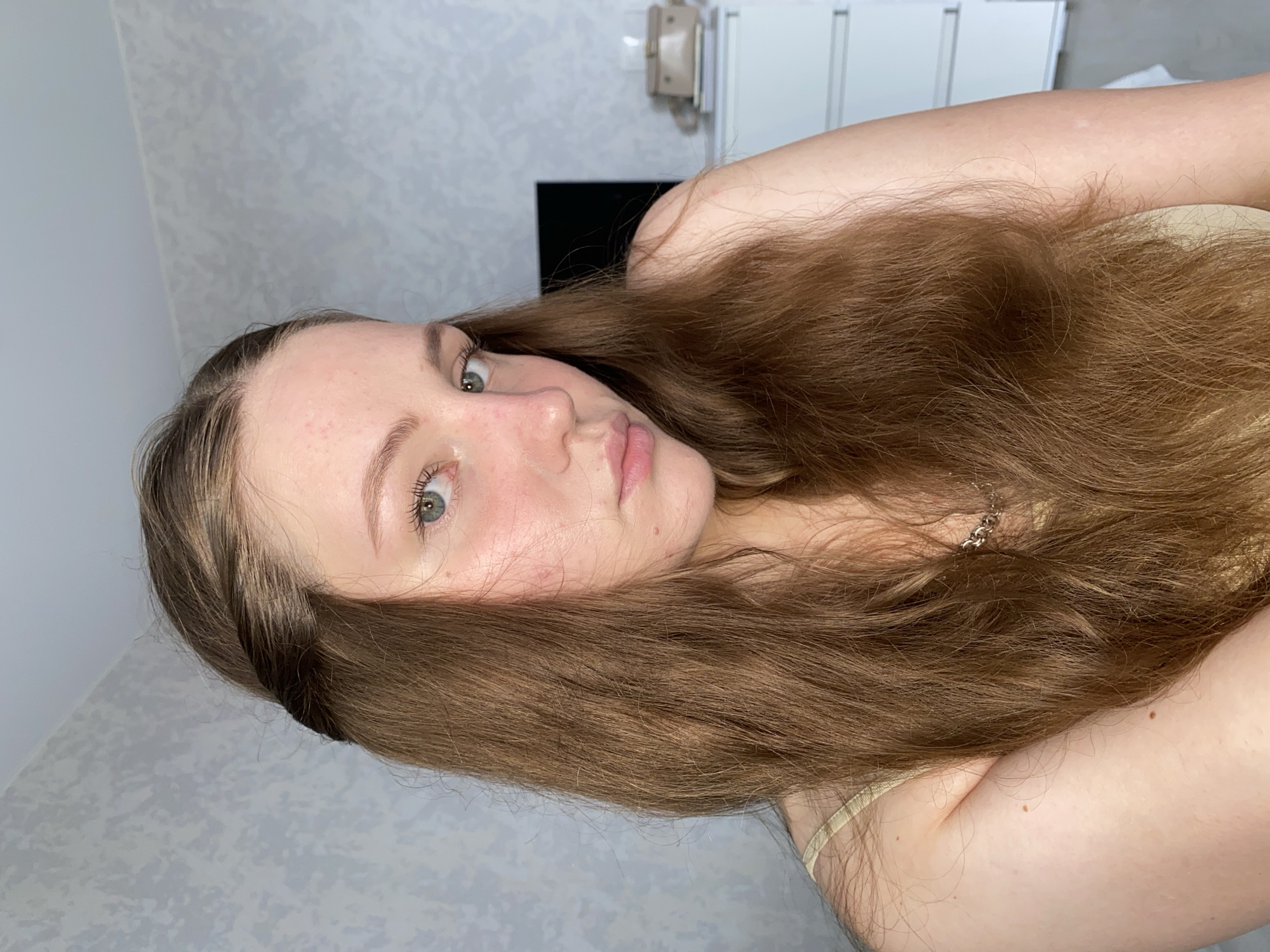 A young woman with long, brown hair is looking directly at the camera. Her hair is parted in the middle, and a section of hair from the left side of her head is twisted and pulled back. She is wearing a light-colored tank top. Her skin is pale, with some redness on her cheeks and forehead. There are a few small blemishes on her face. Her eyes are green. She is positioned in what appears to be a bedroom. In the background, there is a textured wallpaper on the wall, a dresser with drawers, and a television set. The scene is lit by natural light coming from an unseen source. This image was taken indoors, likely in a residential setting. There is no specific information to associate this image with the city of Izhevsk, Russia.