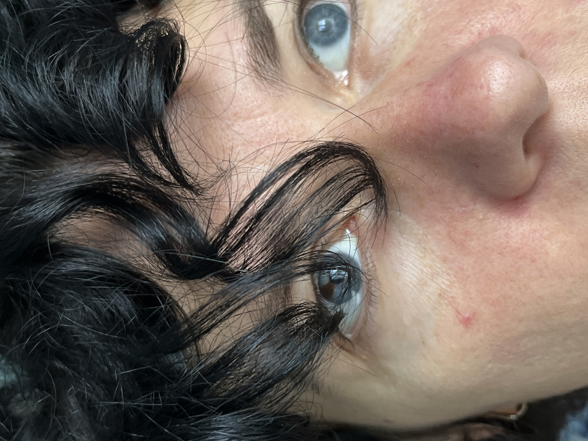 This is a close-up, eye-level, indoor photograph of a person's face, focusing on their eyes, nose, and forehead, with a portion of dark, curly hair obscuring the left eye. The skin appears to have some redness and visible pores. The subject has blue eyes and dark eyebrows. There is a small, reddish mark on the cheek below the right eye. The background is dark and out of focus. The image was taken in ღრმაღელის თემი, Georgia.