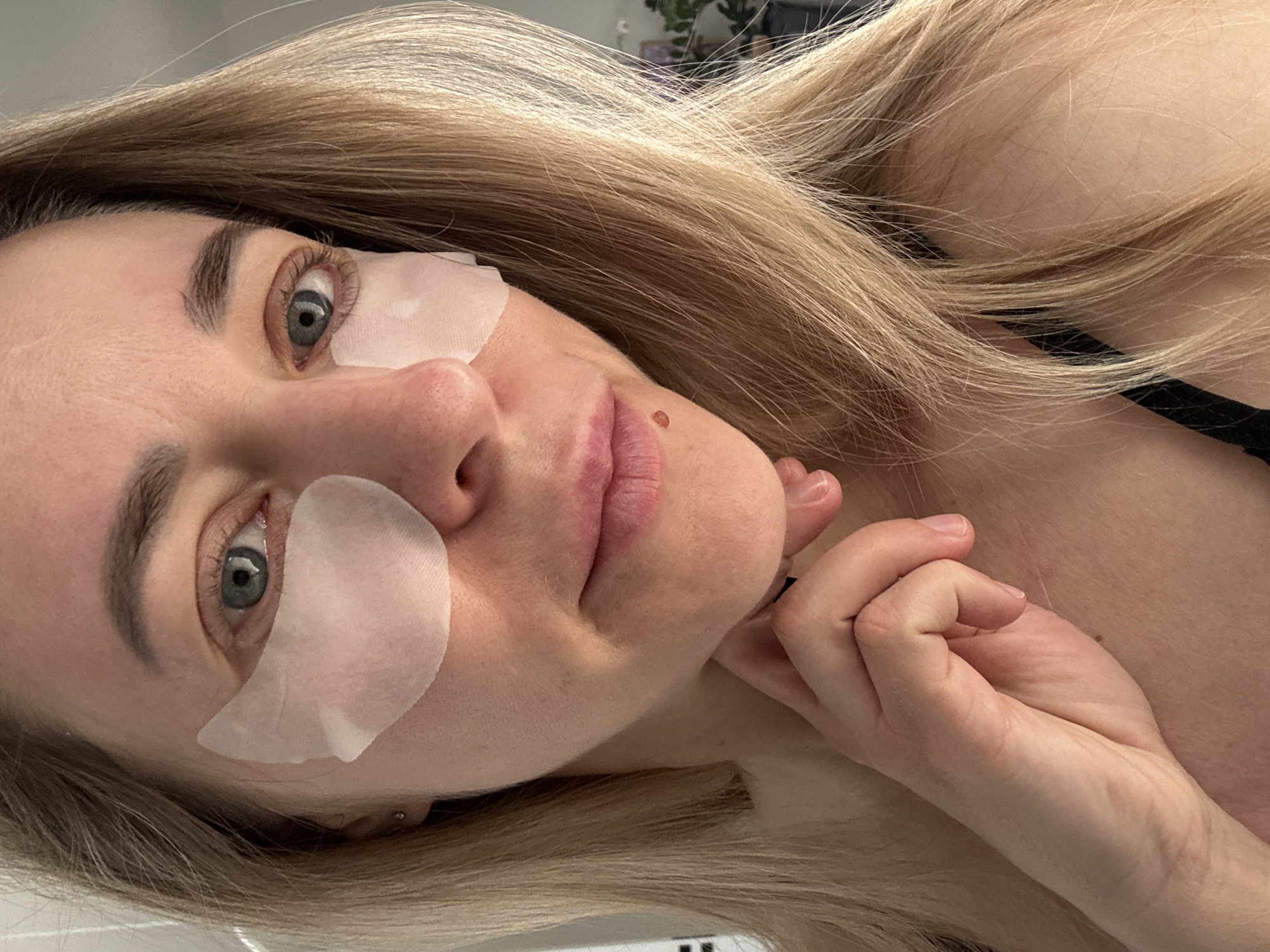 A woman is lying down wearing eye patches. Her hair is blonde and long. Her eyes are blue. She is holding her hand up to her chin. Her skin appears pale. A mole is visible on her face. She is wearing a black top. The location is Chaikovsky, Russia.
