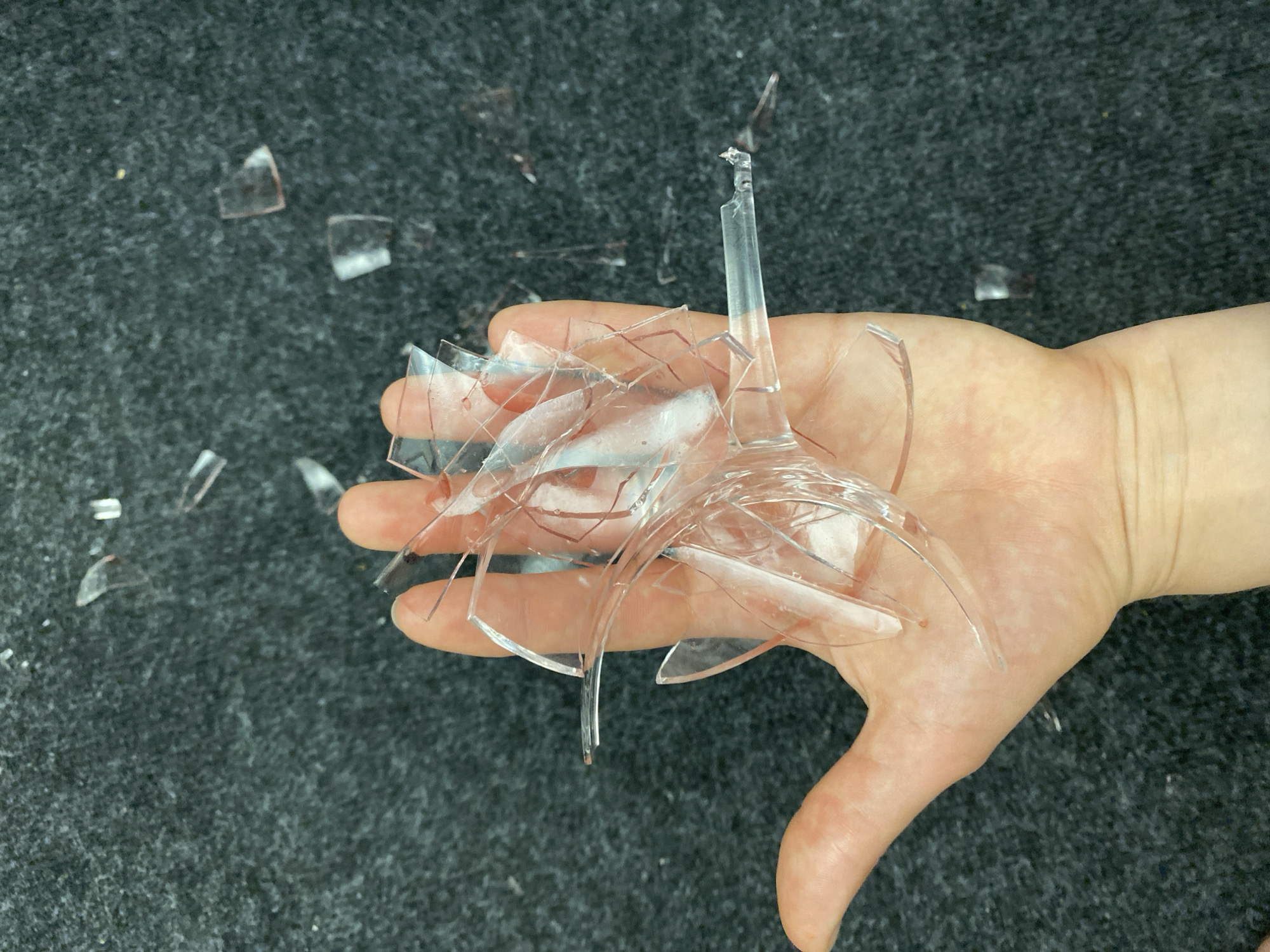 A human hand is holding shattered pieces of clear plastic or glass against a dark, textured surface. The hand is palm up, and the sharp fragments are scattered across the palm and fingers, some protruding outwards. Scattered around the hand are additional small shards of the same material on the dark surface. The lighting appears to be overhead, creating some reflections on the fragments. The image provides a close-up view of the hand and the debris. The location in Moscow, Russia, is not discernible from the visual information presented in the image.
