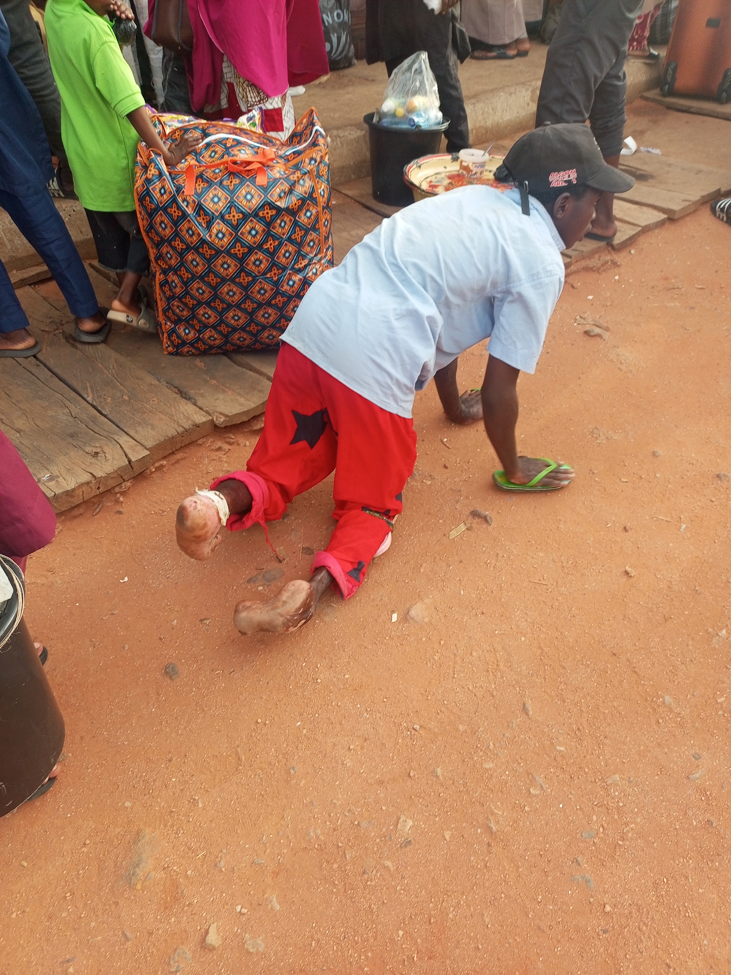 A person, presumably a beggar with amputated legs, is crawling on red soil in what appears to be a public space in Gombe, Nigeria. The person is wearing a light blue short-sleeved shirt, red trousers with a star design, a baseball cap, and a green sandal on one hand. The amputated legs are visible, one covered in a bandage. Other people are visible in the background, standing on a raised wooden platform. There is a large patterned bag nearby, along with other objects like buckets and trays.
