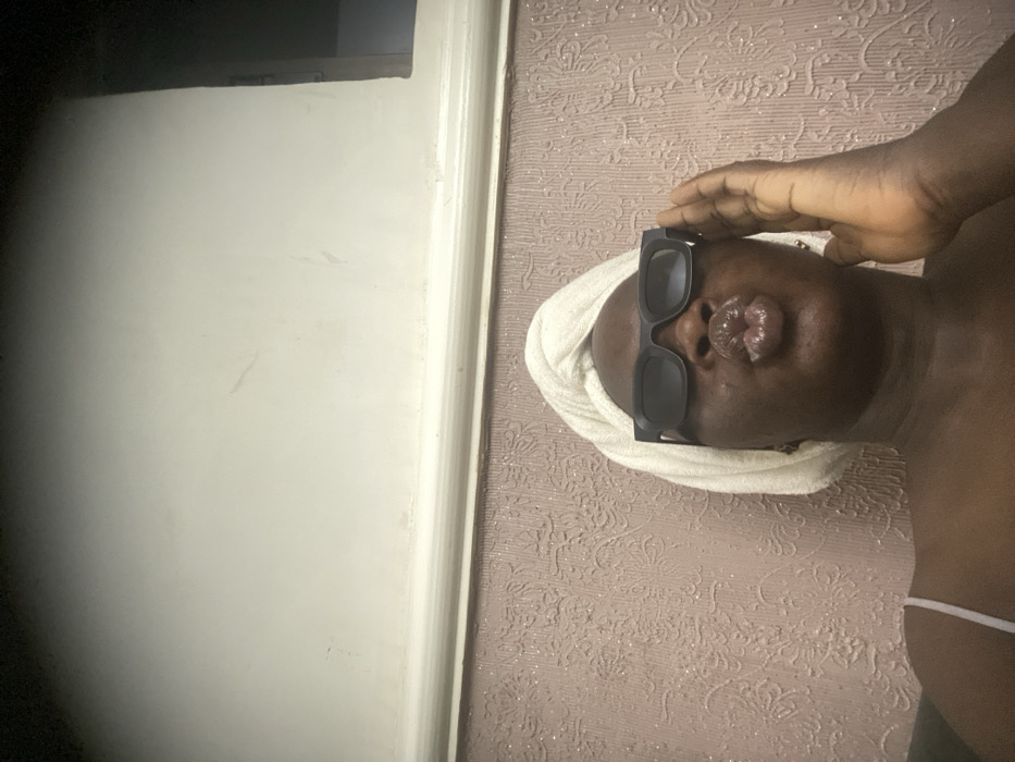 A person wearing sunglasses and a white towel on their head poses sideways. The person holds a hand to the forehead. The background includes textured mauve wallpaper with a floral pattern and a white wall. The image orientation is unusual, with the white wall to the left and the person and wallpaper to the right. A dark object is partially visible in the top left corner.