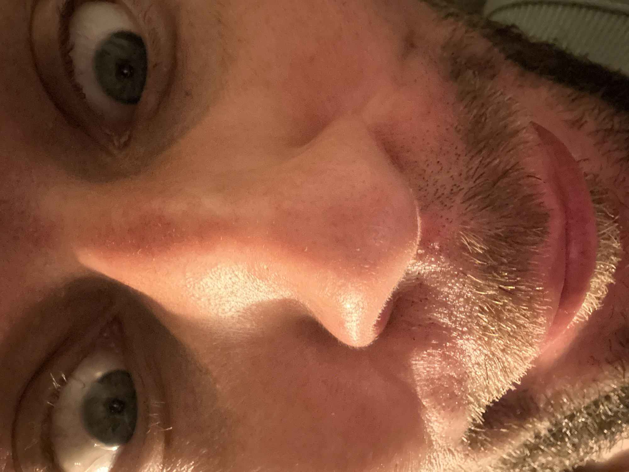 This is a close-up, over-the-shoulder shot of a person's face, taken from a low angle. The subject's eyes are wide open and looking directly at the camera, with dilated pupils. The nose is prominent and appears slightly red. The subject has stubble on their chin and upper lip, forming a light beard. The lighting is warm and casts shadows, highlighting the contours of the face. The background is out of focus and appears to be a light-colored fabric, possibly clothing. The scene is an indoor setting, with no discernable environmental features that would indicate a specific location in Zvezdara Urban Municipality, Serbia.