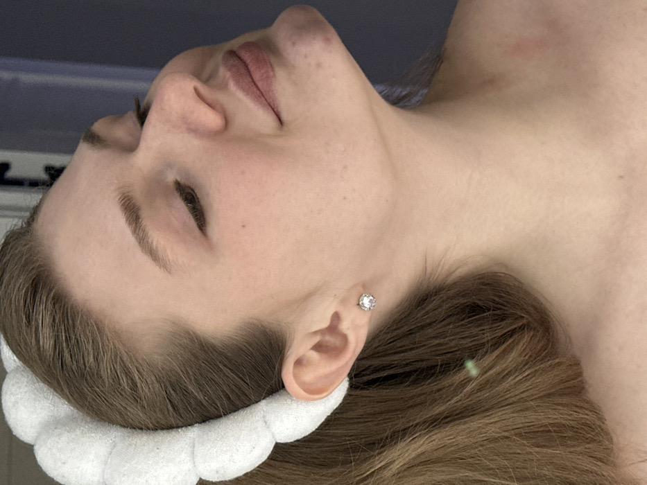 The image displays a close-up profile view of a young adult female, facing right, from the mid-chest upwards. Her fair skin shows small blemishes on the chin and jawline, and reddish marks are visible on the left side of her neck. Her light brown hair is pulled back from her forehead by a white, segmented, terrycloth headband. A single, multi-faceted circular stud earring is present in her visible left earlobe. Her eyes are closed or partially closed, and her head is tilted upwards and slightly backward. Her lips are tinted reddish-pink. The background is an indistinct, uniform dark grey/blue, suggesting an indoor environment. There are no visual cues within the image to specify a location in Kazan, Russia.