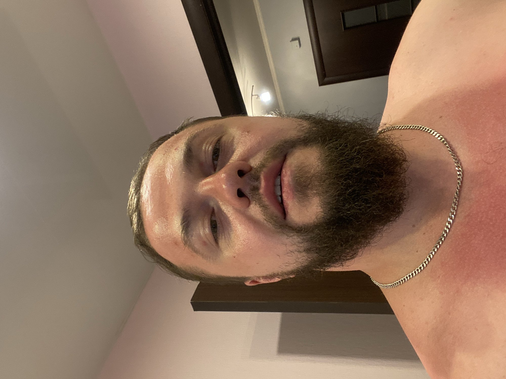 A close-up, head-and-shoulders image of an adult male in an indoor setting in the city of Vladimir, Russia. The man faces forward, looking directly at the camera. He has a dark, full beard and dark hair. His face and forehead exhibit a shiny appearance. His exposed shoulders and neck show significant redness, consistent with sunburn. He wears a silver-toned curb chain necklace. The background features light-colored walls and a ceiling. Dark brown door frames or door edges are visible on both the left and right sides of the frame, with a single ceiling-mounted light fixture present on the upper right.