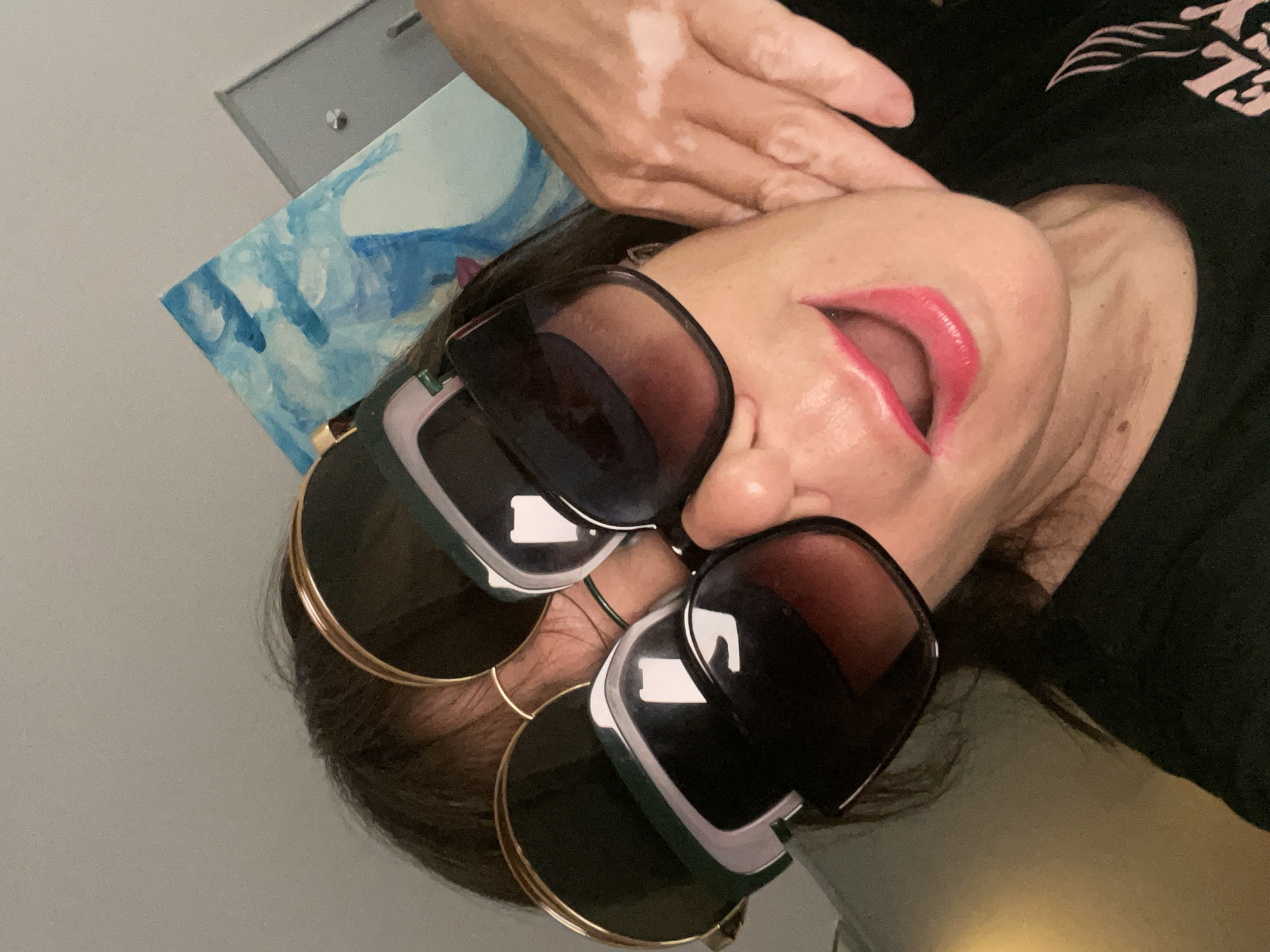 The image shows a woman wearing multiple pairs of sunglasses, with her mouth open and smiling. She is wearing a black t-shirt. Her right hand is raised to her face, touching her cheek, and she has vitiligo on her hand. In the background, there is a painting with blue and white colors, and a grey wall. The location is not specified in the image or accompanying metadata.