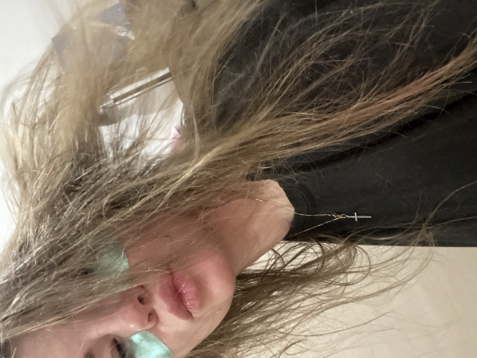 A person with long, layered blonde and brown hair is angled in the frame. Green patches are on the nose and upper cheek. The person's lips are visible. A thin gold necklace with a small cross pendant is near the neck. They are wearing a dark shirt. The background appears to be a white wall and ceiling.
