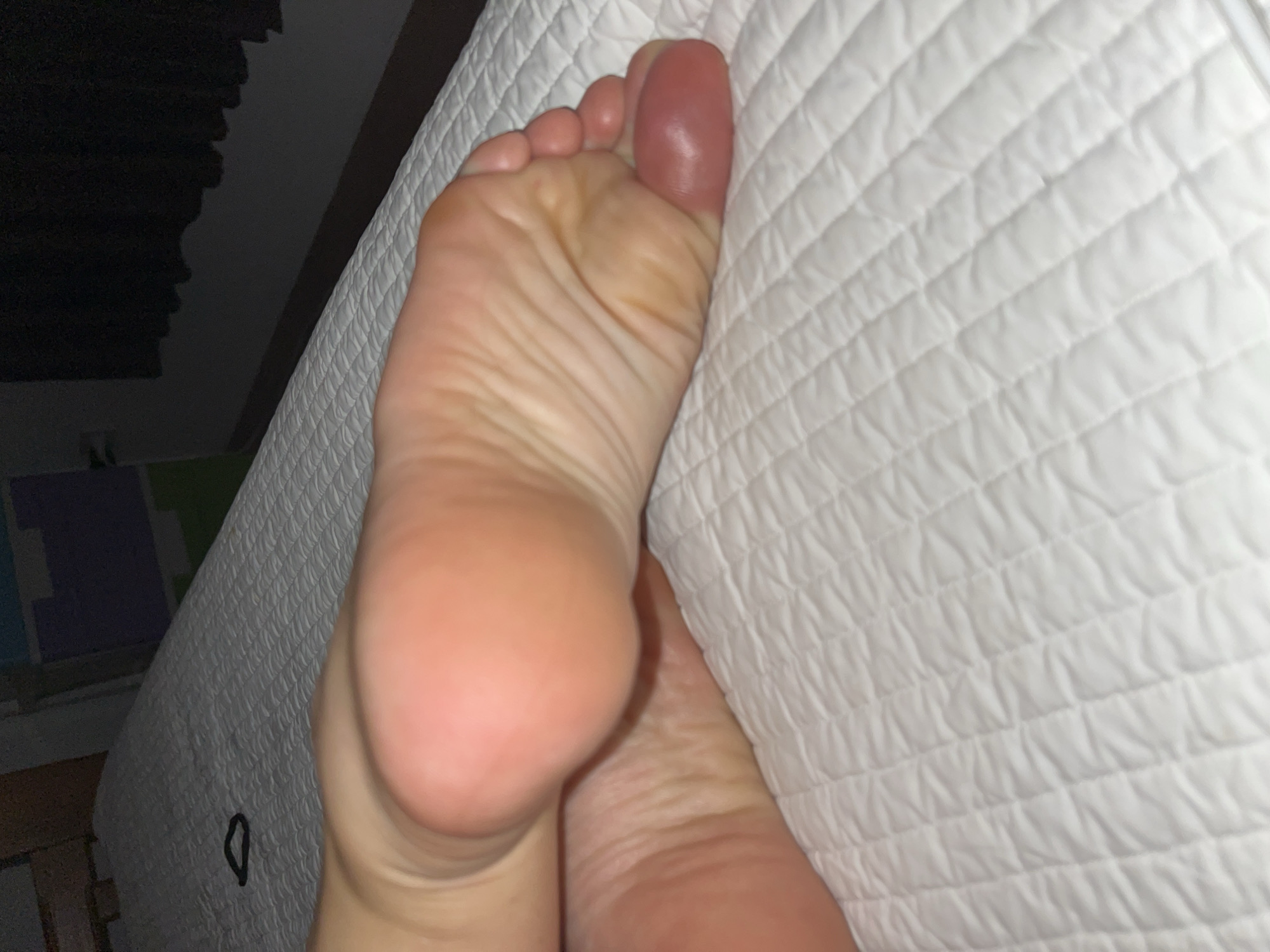 The image shows the sole of a human foot, positioned on a white quilted surface, possibly a bed or mattress. The foot is pale, and the large toe appears reddened and swollen. The environment is dimly lit, suggesting an indoor setting. Background details include dark furniture and a wall with a green and blue color scheme.