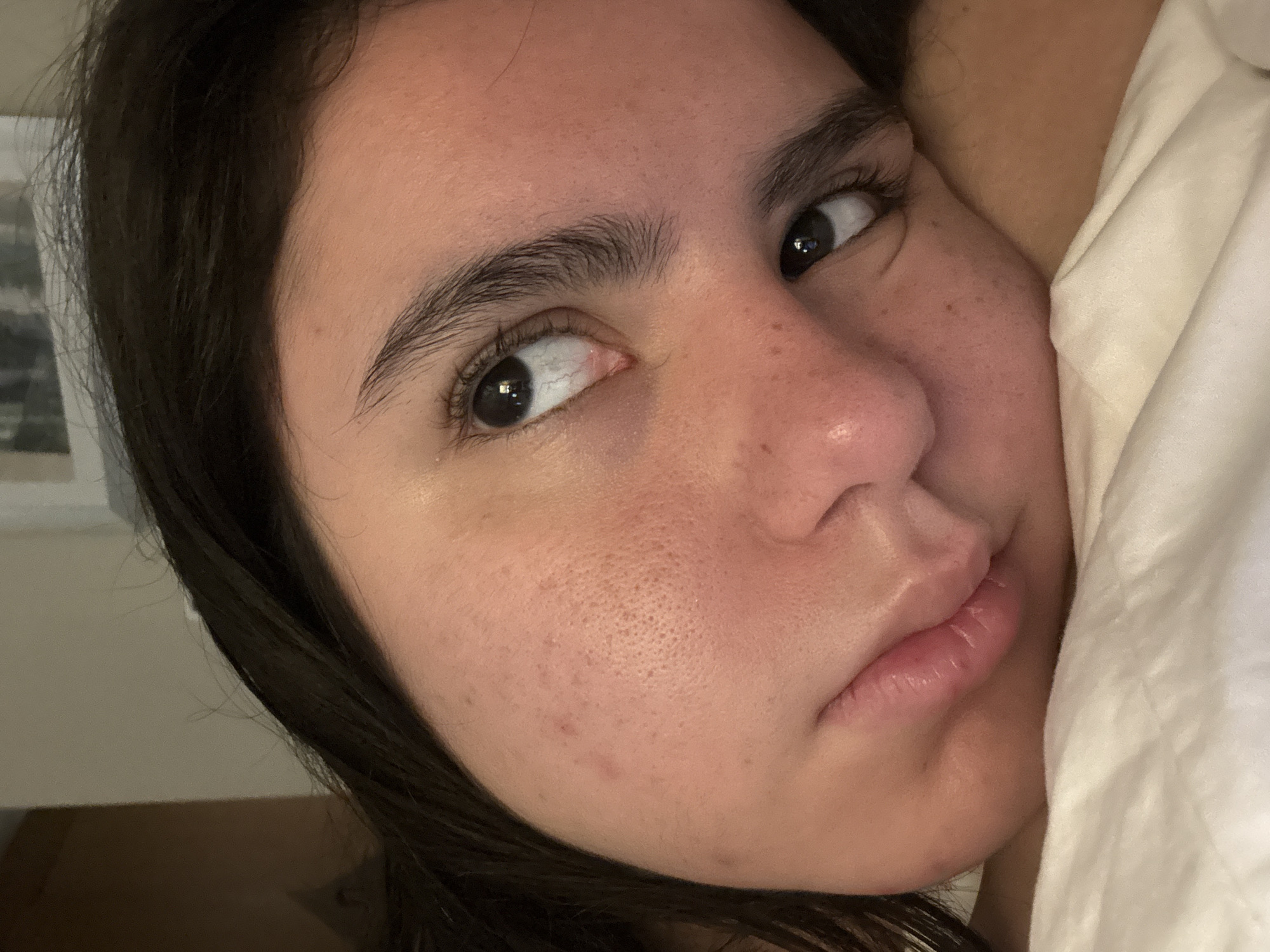 A close-up shot of a person's face, likely female, with dark hair, light skin, and brown eyes. The person is lying down, with their face tilted slightly towards the camera and resting on a white pillow or bedding. The face shows details such as pores, some redness, freckles, and natural eyebrow hair. The overall environment suggests a bedroom setting. There's nothing in the image to indicate the specific location of San Antonio, Texas.