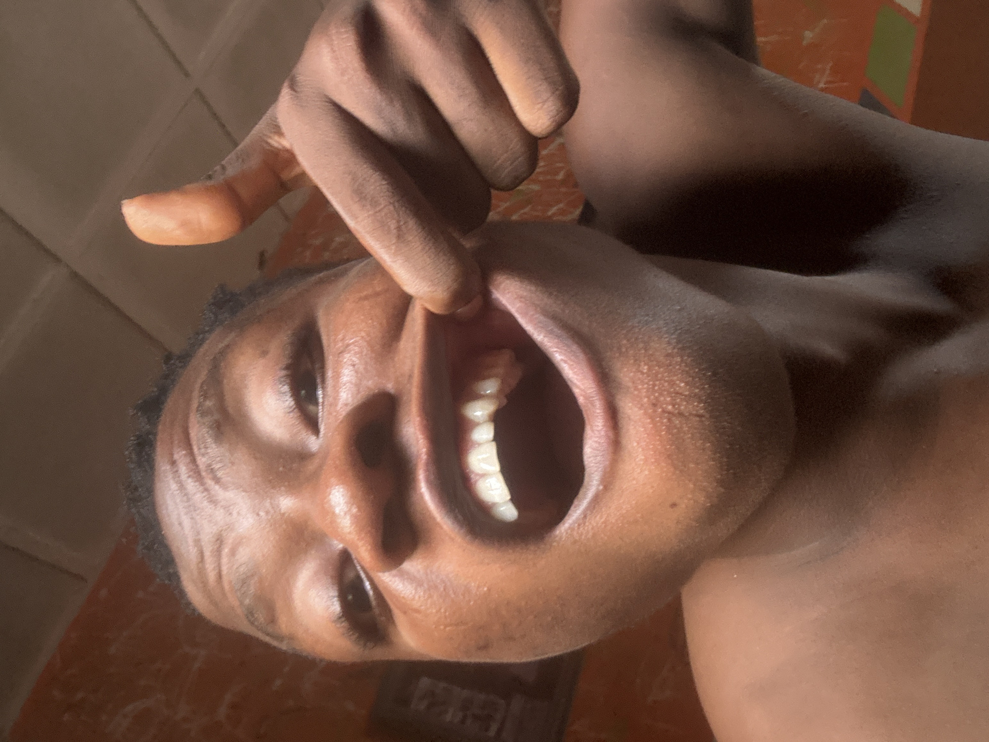 A close-up, selfie-style shot focuses on the open mouth and raised thumb of a dark-skinned individual. The person's mouth is wide open, revealing a row of white teeth and the inside of their oral cavity. A finger is pressed against the side of their mouth, pulling the cheek outward. The background consists of an orange, textured wall and a ceiling with square panels. The image appears to have been taken indoors in a residential setting in Ikorodu, Nigeria.