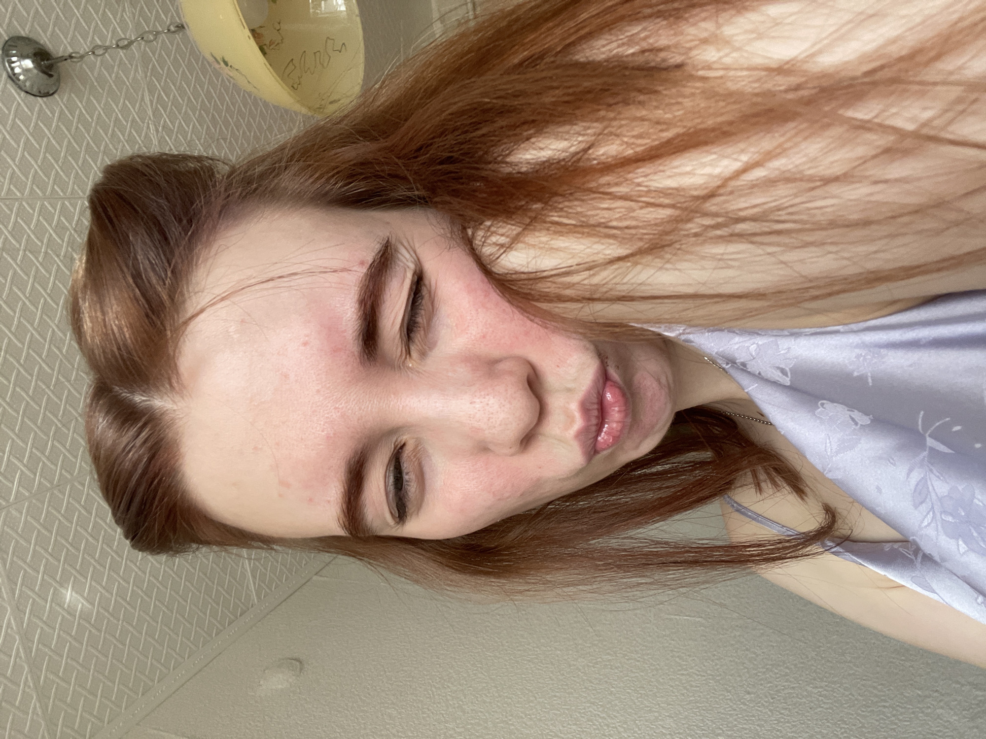 An indoor, close-up, and rotated image shows a person, likely female, with long reddish-brown hair. The person's face is visible, with eyes closed and lips pursed in a "duck face" or kissing gesture. Reddish patches are visible on the skin, particularly on the cheeks and forehead.
The person is wearing a light purple top or dress with a subtle floral or leaf pattern, and a thin silver chain necklace is visible around their neck. Their hair cascades down the side of their head.
In the background, a textured wall with a diagonal grid pattern is visible. An overhead light fixture with a yellow, bowl-shaped cover is attached to this wall by a chain. Faint, illegible scribbles are present on the yellow fixture. The lower part of the image features a plain, light-colored surface, possibly another wall or a floor. The overall impression is a casual, possibly playful, selfie taken in a domestic setting.