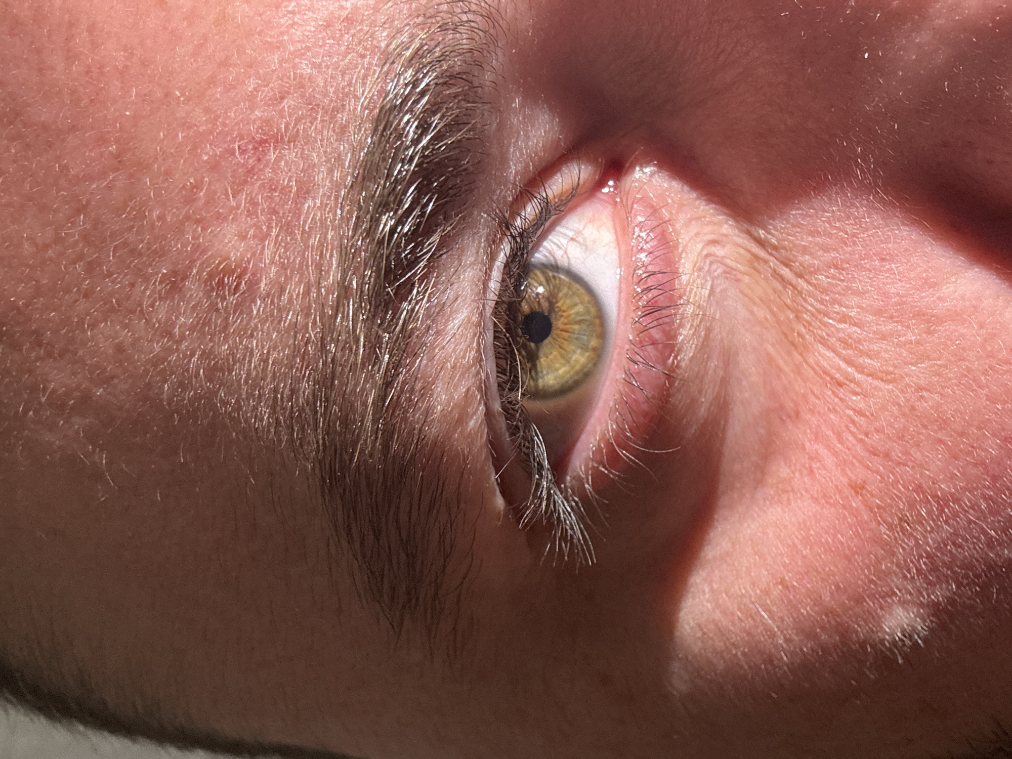 A close-up of a person's eye, with green and brown iris, eyelashes, and eyebrows. The skin around the eye is visible, showing hair follicles and some skin texture. The lighting is uneven, creating shadows on the face. The image location is indeterminable.