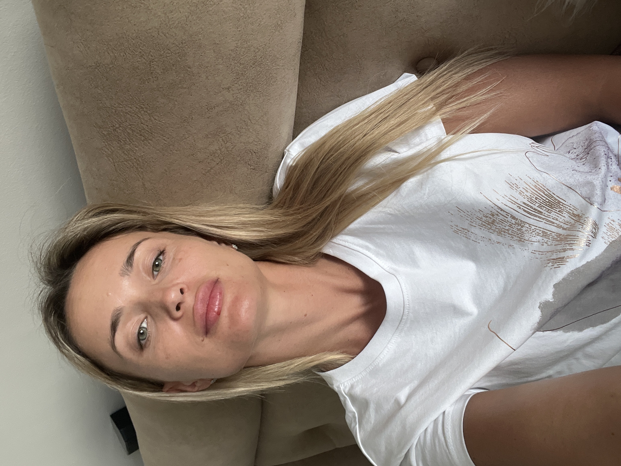 A blonde woman with green eyes is looking at the camera, resting her head on a cushioned surface. She is wearing a white t-shirt with a metallic pattern. Her lips appear slightly swollen and red on the left side, with a visible mark. The background is a textured, light brown surface, possibly a sofa or headboard. The image appears to have been taken indoors, with soft lighting. There is no indication of the location being Sharm El Sheikh, Egypt.