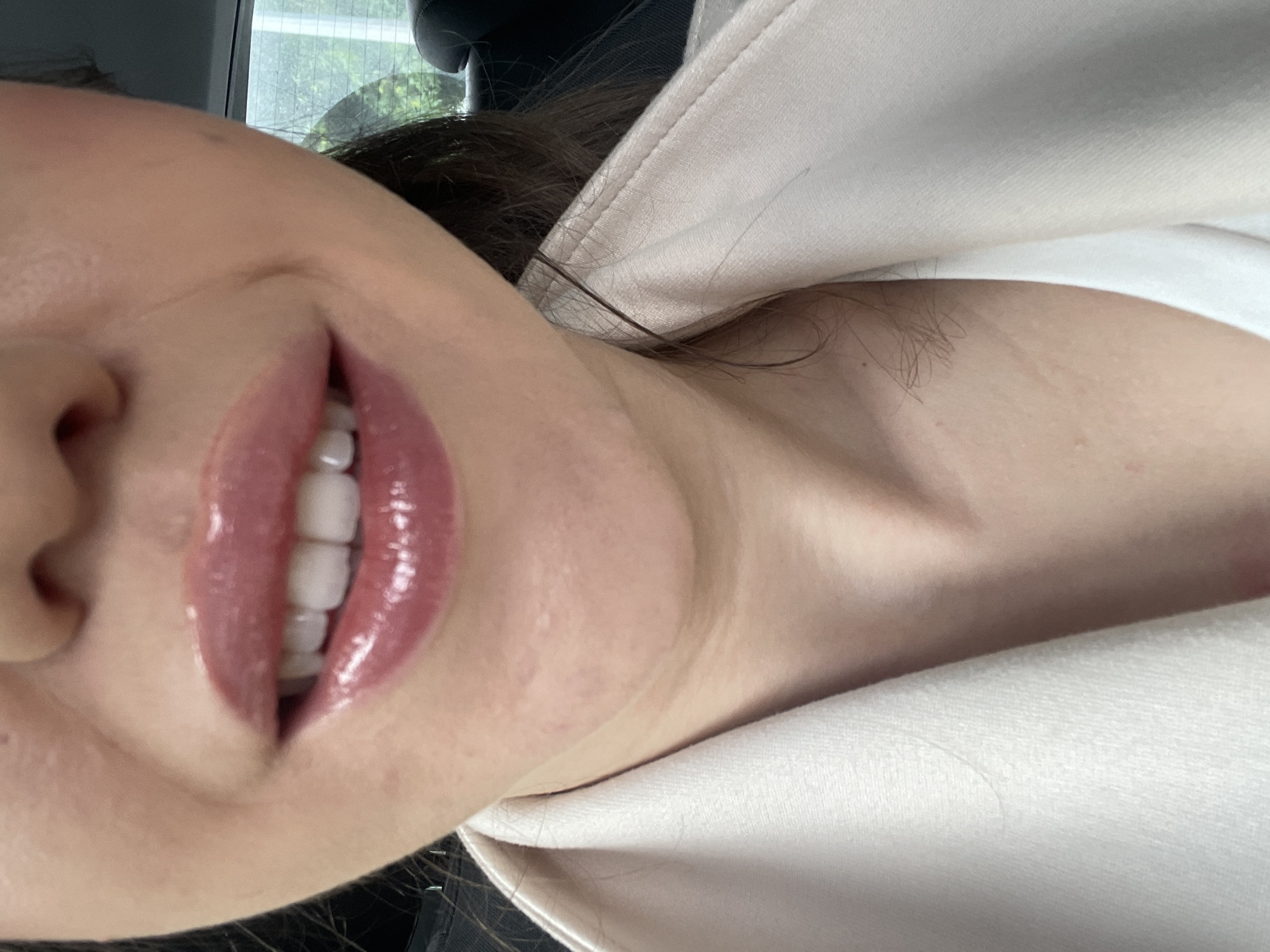 The image is a close-up, highly tilted portrait of a person, likely a selfie, taken from a low angle. The subject's face is oriented diagonally, with the nose and part of the cheek visible on the left, extending down to the chin, neck, and part of the upper chest on the right. The setting appears to be the interior of a car in Sofia, Bulgaria.
The primary focus is the person's mouth, which is open in a wide, radiant smile, revealing a set of straight, white teeth. The lips are coated in a prominent, high-shine, glossy lip product, appearing to be a light pink or berry hue, which reflects light intensely. The skin around the mouth, chin, and neck is fair and appears smooth. Dark hair is visible, cascading around the neck and behind the ear.
The person is wearing a light-colored garment, possibly a hoodie or sweatshirt, in an off-white or light beige tone, which is visible around the neck and shoulder. The fabric appears soft and textured. In the blurred background, through what seems to be a car window, soft green foliage from trees or bushes is visible, indicating it is daytime. Parts of the car's interior, such as a dark seat or headrest, are also indistinctly present. The overall mood conveyed by the clear smile and bright lips is one of happiness or contentment. No text is visible in the image.