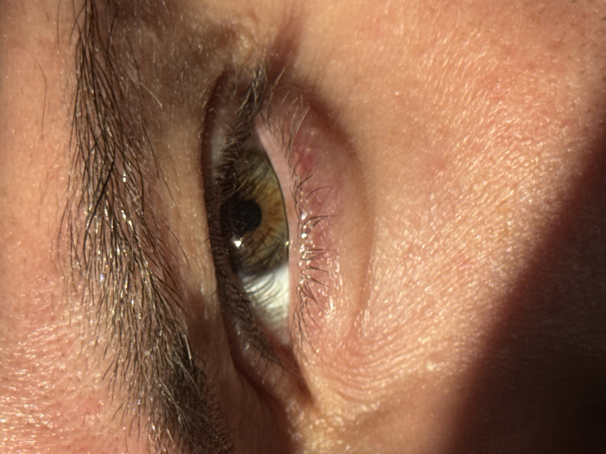 A close-up photograph shows a human eye. The iris is hazel with hints of green and brown. The surrounding skin exhibits fine lines and pores. Eyelashes are visible on both the upper and lower lids. An eyebrow, covered in small droplets of water, is positioned above the eye. The lighting is uneven, creating shadows on the skin. There is no information to discern a location in Esch-sur-Alzette, Luxembourg.