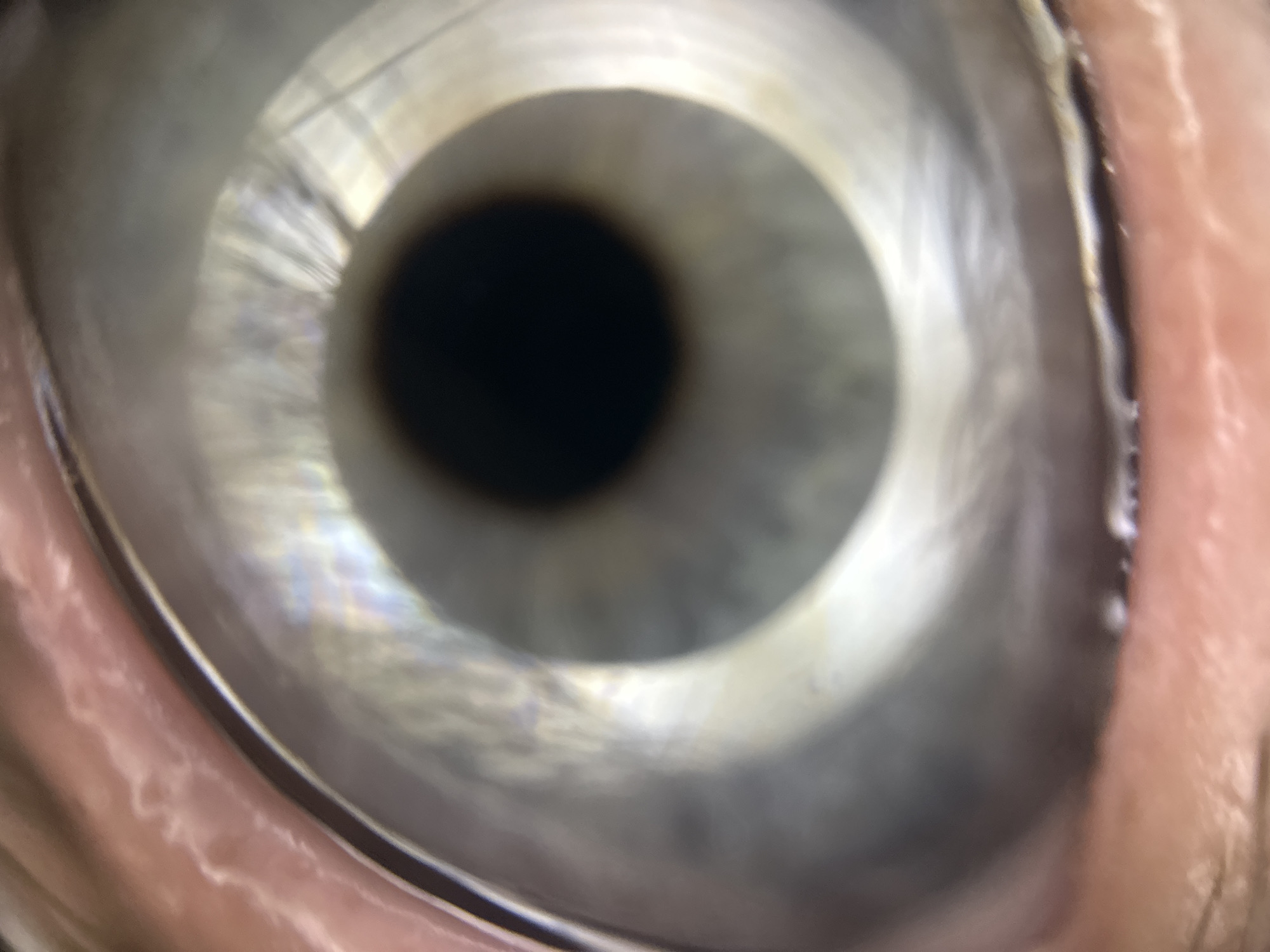 The image is a close-up of a human eye, focusing on the iris and pupil. The iris appears to be light blue or grey with visible radial striations. The pupil is dark and circular, centrally located within the iris. The surrounding skin, likely part of the eyelid or brow, is visible at the edges of the frame, showing texture and a pinkish hue. The lighting in the image creates some reflections and highlights on the surface of the eye. There are no discernible elements in the image that would allow for localization to Đà Nẵng, Vietnam.