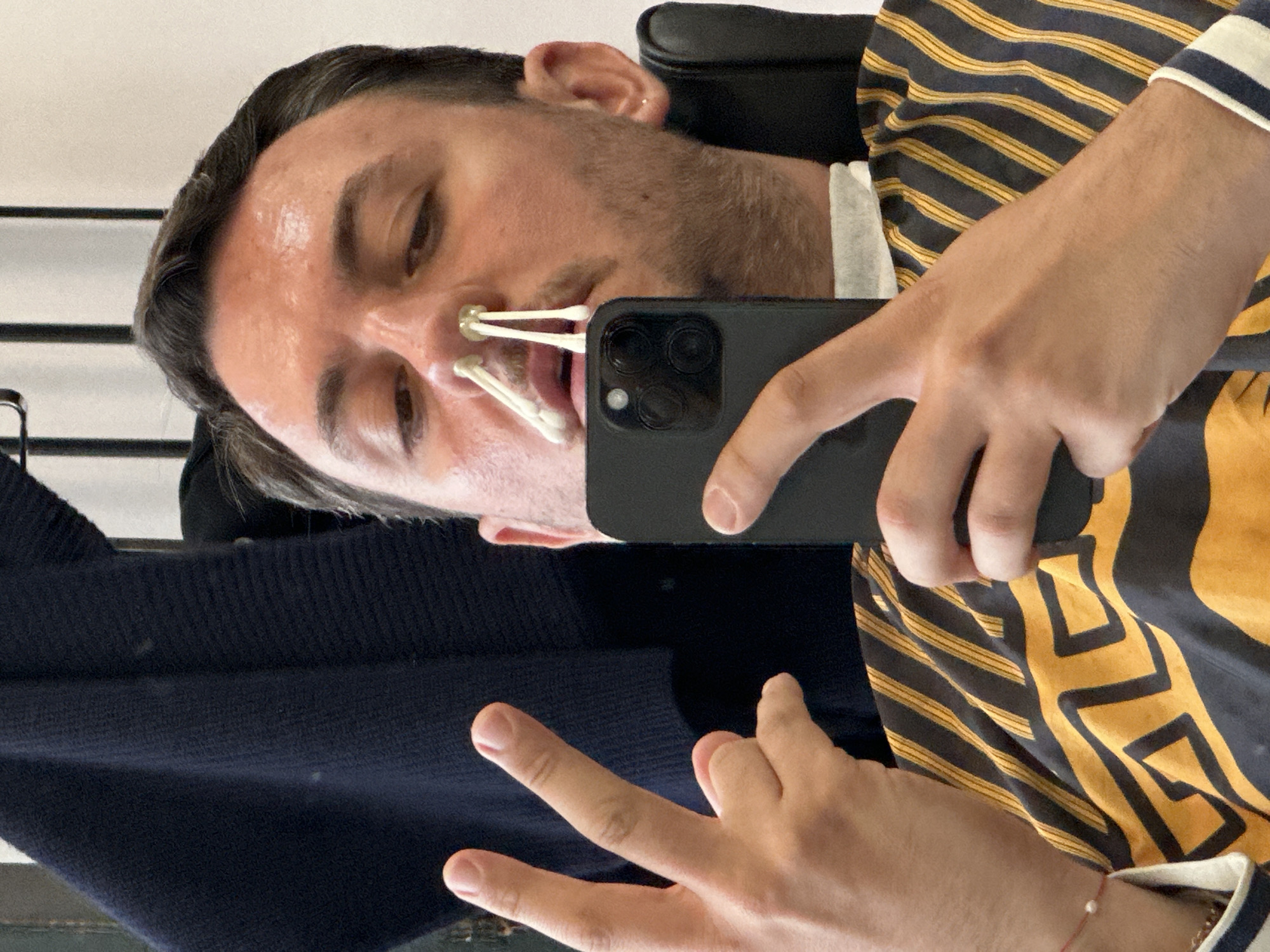 A man is taking a selfie with his smartphone. He is sitting in a chair with a black leather back. He has three cotton swabs inserted into his nostrils. He is wearing a shirt with a black and gold zigzag pattern and a navy-blue sweater. His right hand is making a peace sign. The location is not identifiable from the image.