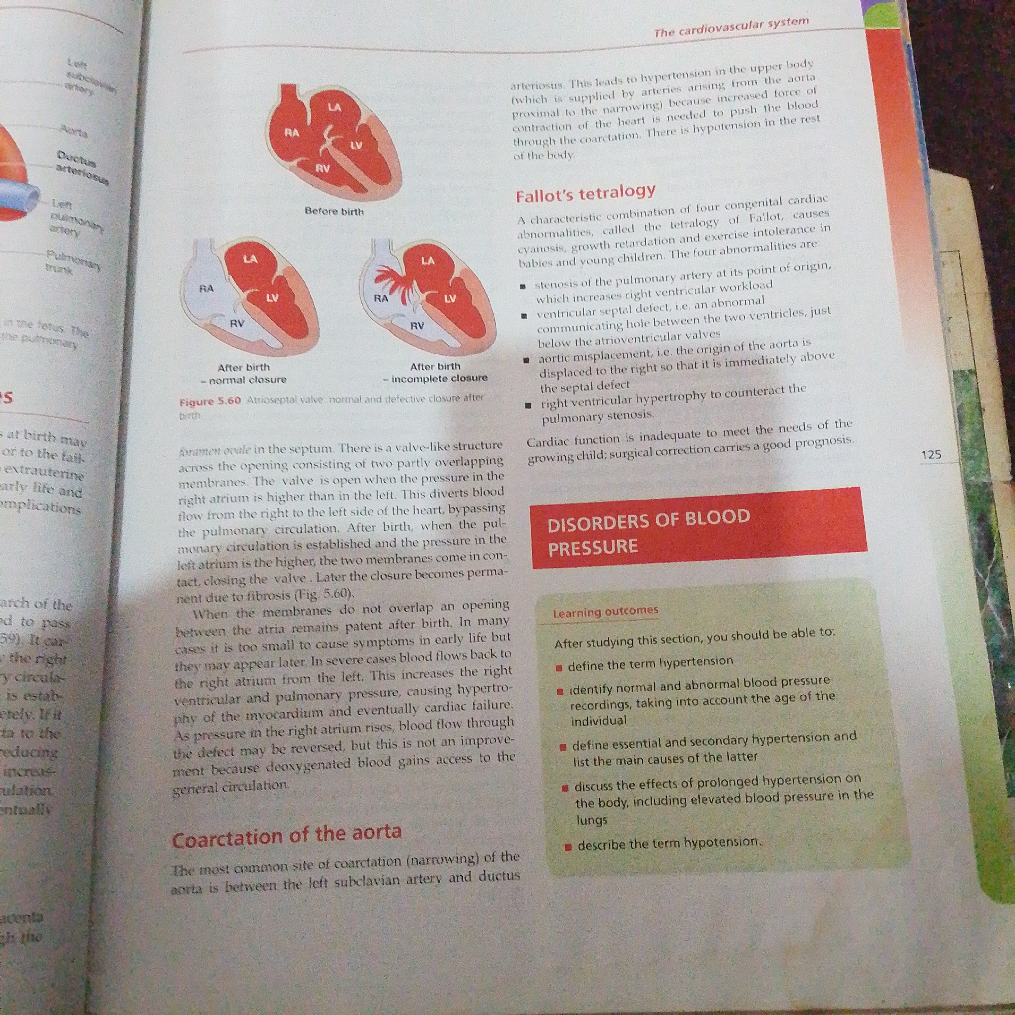 The image is a photograph of a page from a medical textbook, specifically discussing the cardiovascular system. The page contains text and diagrams related to fetal circulation, heart defects, and blood pressure disorders.
The text on the left side of the page describes fetal circulatory structures like the aorta, ductus arteriosus, and pulmonary artery. Below this, there is text discussing the foramen ovale and its closure after birth.
The central part of the page displays two diagrams of the heart, one labeled "Before birth" and the other "After birth - normal closure" and "After birth - incomplete closure." These diagrams illustrate the differences in heart structure before and after birth.
To the right of the heart diagrams, there is a section titled "Fallot's tetralogy," which describes a congenital heart defect and lists its four abnormalities.
Below "Fallot's tetralogy" is a red box with the heading "DISORDERS OF BLOOD PRESSURE." Underneath this, there is a section titled "Learning outcomes," which outlines what a student should be able to do after studying this section, such as defining hypertension and identifying causes of secondary hypertension.
At the bottom of the page, there is a heading "Coarctation of the aorta," which begins to describe this condition.
The image is taken from a book that is open, and a portion of a second page is visible on the right edge, with the number "125" visible. The lighting suggests it's an indoor setting, likely a library or study environment. There is no discernible information within the image that relates to the city of Jalingo, Nigeria, or any specific geographical location.