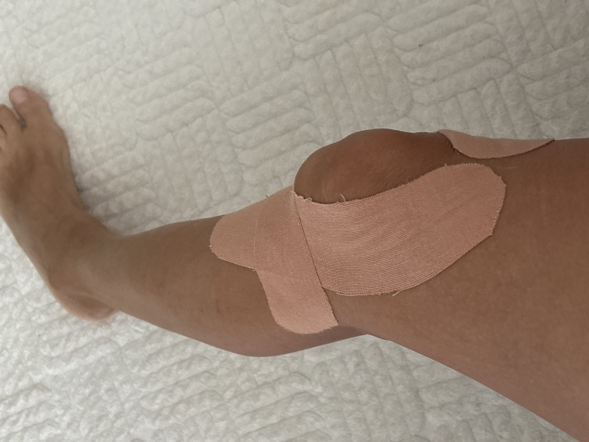 The image shows a close-up view of a person's leg, from the mid-thigh down to the toes, resting on a white, textured surface. The leg is adorned with athletic tape applied around the knee joint, suggesting support or treatment. The skin tone appears to be light to medium. The white surface beneath the leg has a quilted or padded texture, possibly a bedsheet or medical padding. The lighting is bright and even, casting minimal shadows. There is no indication of the specific location in Chaikovsky, Russia, or any urban environment.