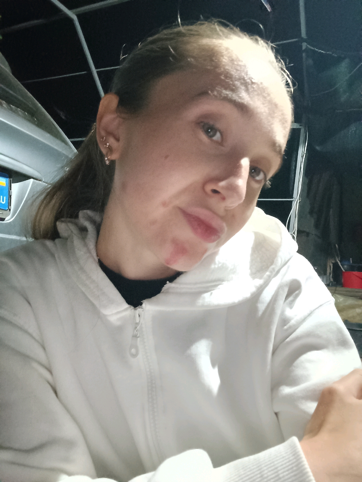 A young woman with blonde hair pulled back and wearing a white hooded sweatshirt is looking at the camera. Her head is tilted slightly and her expression is neutral. She has a small earring in her left ear. There are some reddish marks on her chin and neck. The background is dark and appears to be indoors, with some metal structures and black material visible. A blue and yellow sign with the letters "EU" is partially visible on the left side of the frame. The image was taken in the city of Vypasne, Ukraine.