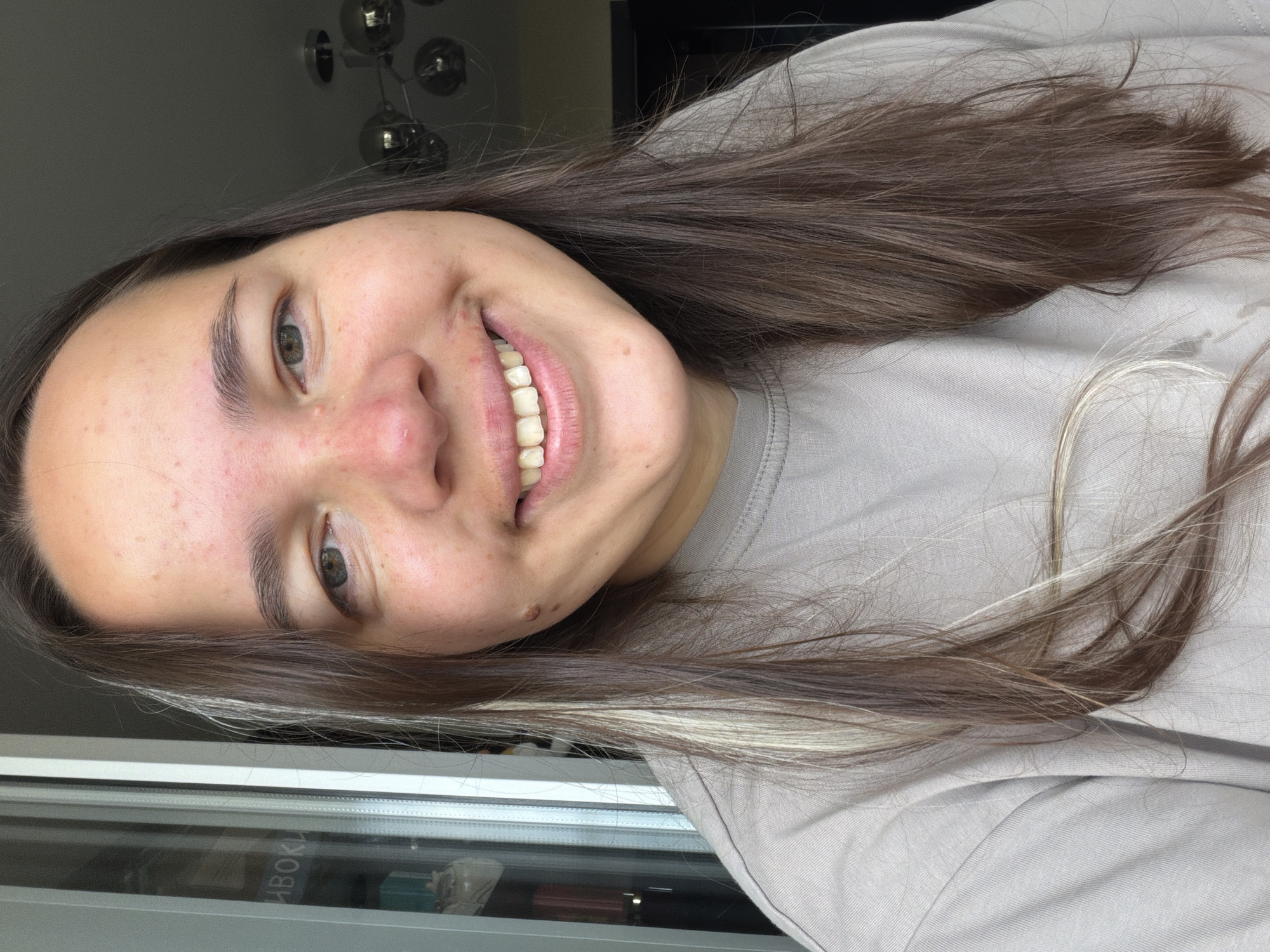 A portrait of a young woman with long, brown hair with blonde highlights. She is wearing a light gray t-shirt and is smiling broadly. Her face is visible from the shoulders up. The background is blurred, but appears to be an indoor setting with natural light coming from a window on the left side of the frame. A light fixture with multiple globes is visible in the upper right corner. The woman has a mole on her right cheek and several blemishes on her forehead and nose.