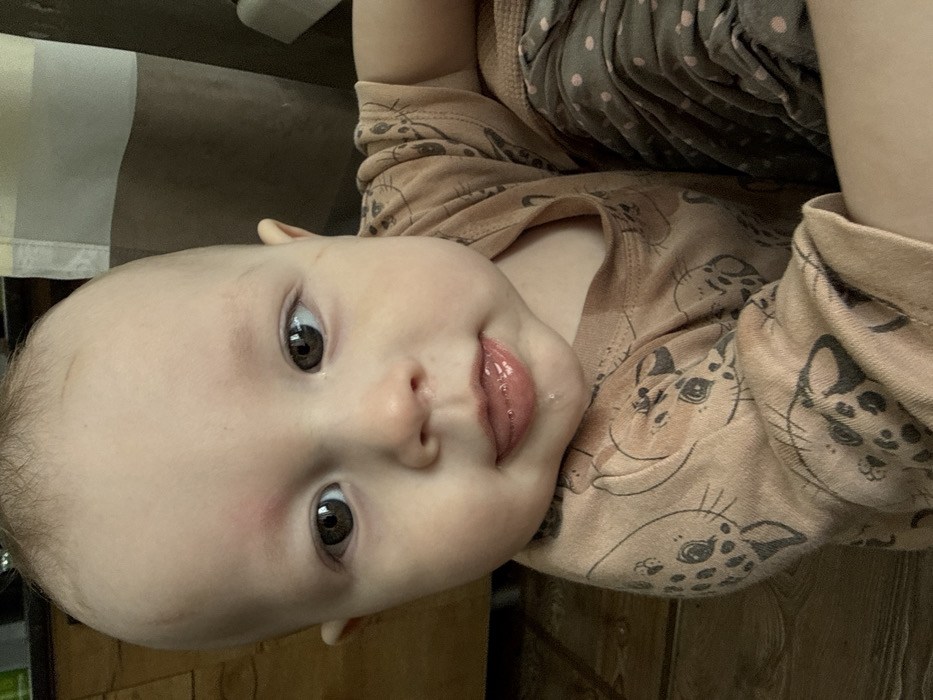 A close-up photograph depicts an infant or toddler positioned at eye level, facing directly forward. The subject has fair skin, brown eyes, and sparse light-colored hair. A distinct reddish mark, approximately 1 cm in diameter, is visible on the forehead, superior to the left eyebrow. The baby's mouth is slightly open with the tongue partially extended, revealing several drops of clear saliva on the tongue and lower lip. The nose appears to have moisture on its tip. The infant wears a short-sleeved, light brown garment patterned with dark, stylized animal faces. A section of dark gray or brown pants with light polka dots is visible on the right side of the frame. The background on the right features a vertical, striped element, possibly a curtain or wall covering, displaying light and dark brown bands. The lower-left foreground shows a light brown wooden floor with visible plank lines. The scene is located indoors, in a residential setting within the city of Кипчак, Russia.