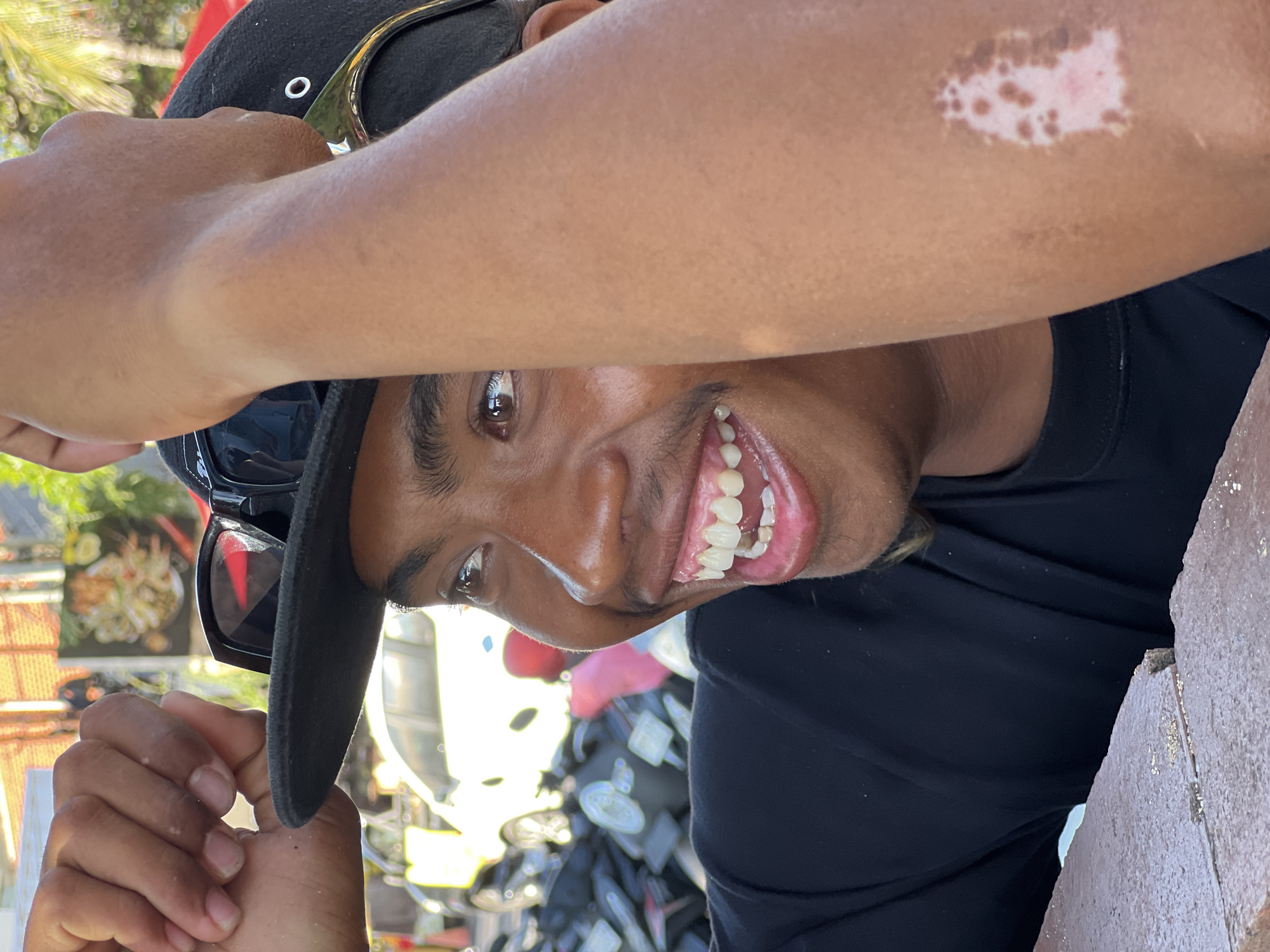 In Kuta, Indonesia, a young man with a warm smile is captured in a close-up portrait. He wears a black t-shirt and a black baseball cap, with sunglasses perched on top. His left arm is raised, resting on his head, while his right arm is bent, the forearm crossing his chest. A patch of vitiligo is visible on his right arm. In the background, a bright yellow car is parked amongst a multitude of motorcycles, suggesting a bustling street scene. A glimpse of a food stall with a colorful display can be seen further in the distance. The foreground features a textured brick surface.