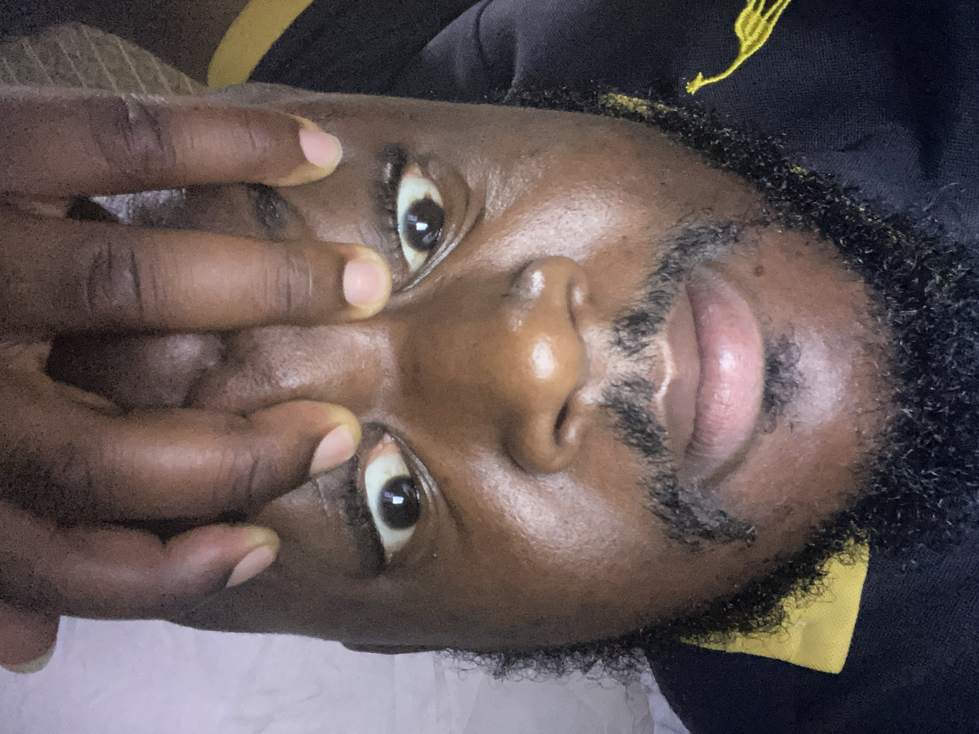 A close-up, low-angle portrait of a dark-skinned man with a mustache and short, curly beard. His left hand is positioned near his face, with two fingers close to his left eye. He is wearing a dark-colored top with a yellow design or accent visible at the collar. The background is blurred and indistinct. There is no information about location, city, or country available from the image.