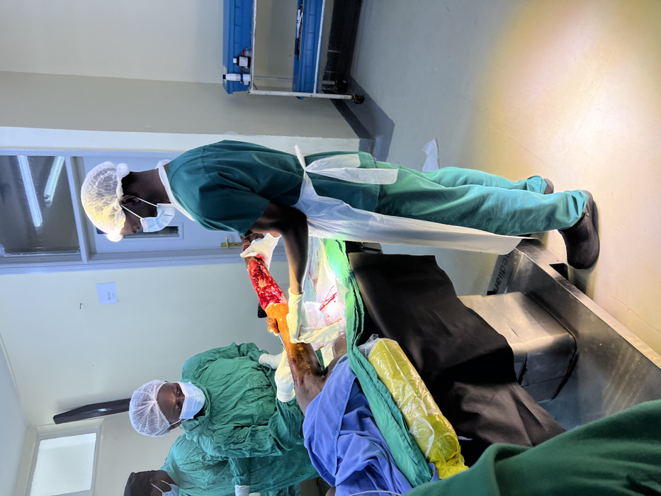 An operating room in a medical facility in Nairobi, Kenya, is depicted during a surgical procedure. Three medical personnel are visible, dressed in green scrubs, white surgical caps, and face masks. One individual, right of center, wears a white disposable apron and holds a severely injured or amputated human lower leg, presenting exposed muscle and bone tissue. A second individual, center-left, attends to the patient's upper leg, which is covered by blue and green surgical drapes on a metallic operating table. Blood is present on the drapes around the surgical field. A third individual is partially visible on the far left. In the background, a light-colored wall features a white door marked "MR-007" and a blue two-tiered medical cart stocked with supplies. Overhead fluorescent lighting illuminates the scene.