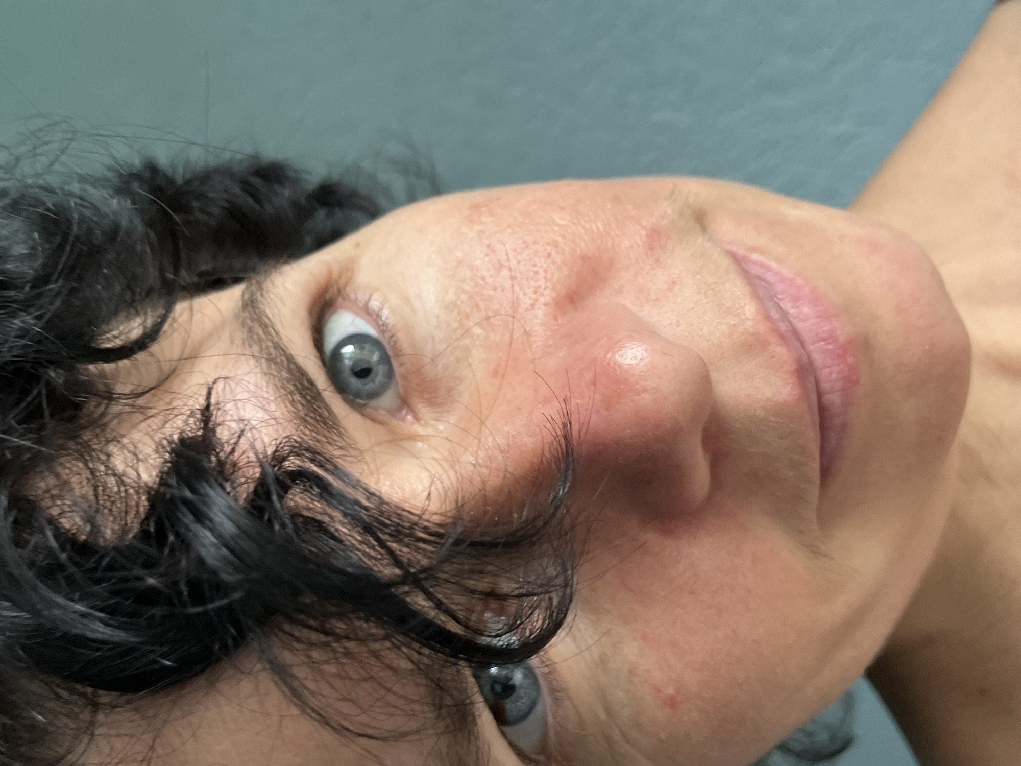 The image is a close-up, high-angle, eye-level shot of a person's face, specifically focusing on their eyes, nose, and mouth. The individual has dark, curly hair that partially obscures their face. Their eyes are blue and appear to be looking directly at the camera. The skin shows some redness and texture, particularly on the cheeks and around the nose. The background is a solid, muted blue-green color, suggesting an indoor setting. There is no indication of a specific location within ღრმაღელის თემი, Georgia.