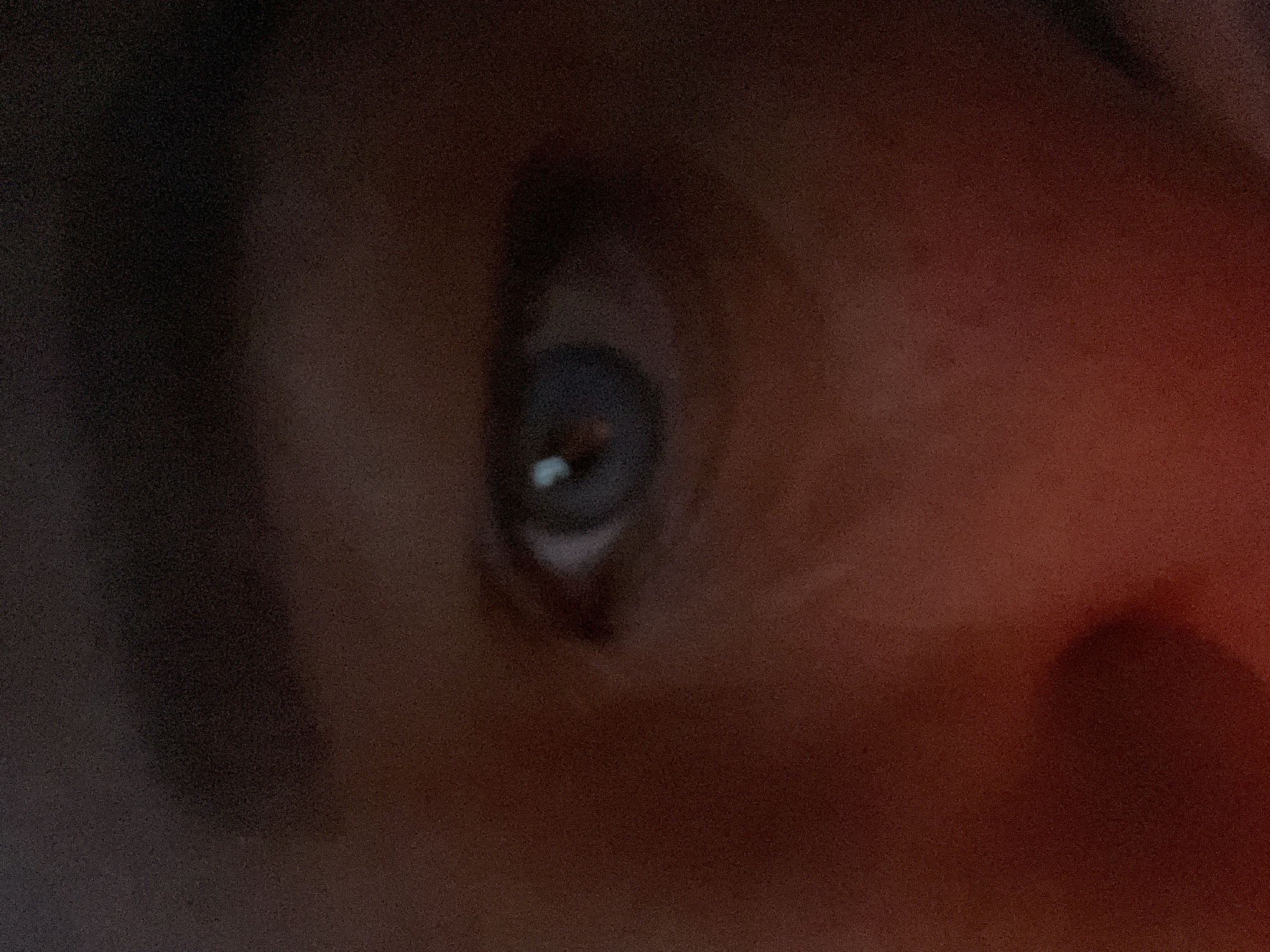The image shows a close-up of a person's eye. The eye is partially open, with a visible blue iris and a white reflection. The surrounding skin appears to be reddish. The image is grainy and has a shallow depth of field. The location and further details are indiscernible.