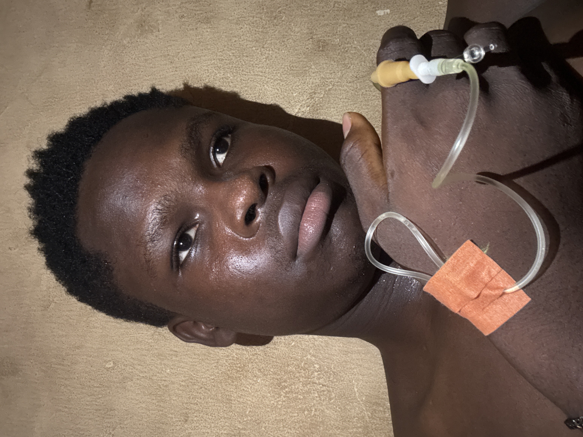 A close-up, slightly rotated image shows a young, dark-skinned person lying on a beige surface. The person has short, dark hair and is looking directly at the camera with a neutral expression. An intravenous (IV) line is visible; it is attached to the person's hand and secured with an orange bandage on the upper chest area. The setting appears to be indoors, with soft, indirect lighting. There is no evidence of a location.