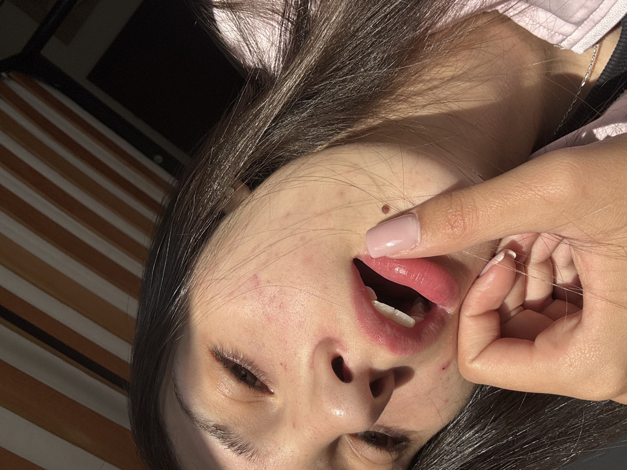 A close-up, low-angle shot focuses on the face and upper torso of a young person, likely a female, with dark hair and fair skin. The individual's left eye is partially closed, with dark eyelashes and eyebrows visible. The nose is slightly tilted upwards. The mouth is open, with plump, glossy pink lips. The tip of a finger, with a light pink fingernail, is touching the lower lip. A small, dark mole is visible on the cheekbone to the right of the nose. The skin shows some redness and minor blemishes. The person is wearing a light pink, quilted jacket over a dark garment, with a delicate silver chain necklace visible at the collarbone. Sunlight casts shadows across the face, highlighting the contours and creating a warm glow. In the background, a striped surface, likely an umbrella or awning with alternating orange-brown and white stripes, is visible at an angle. The scene is set outdoors, with the background suggesting an urban or suburban environment, possibly near Bistritsa, Bulgaria, given the lighting and outdoor setting, though this cannot be definitively confirmed.