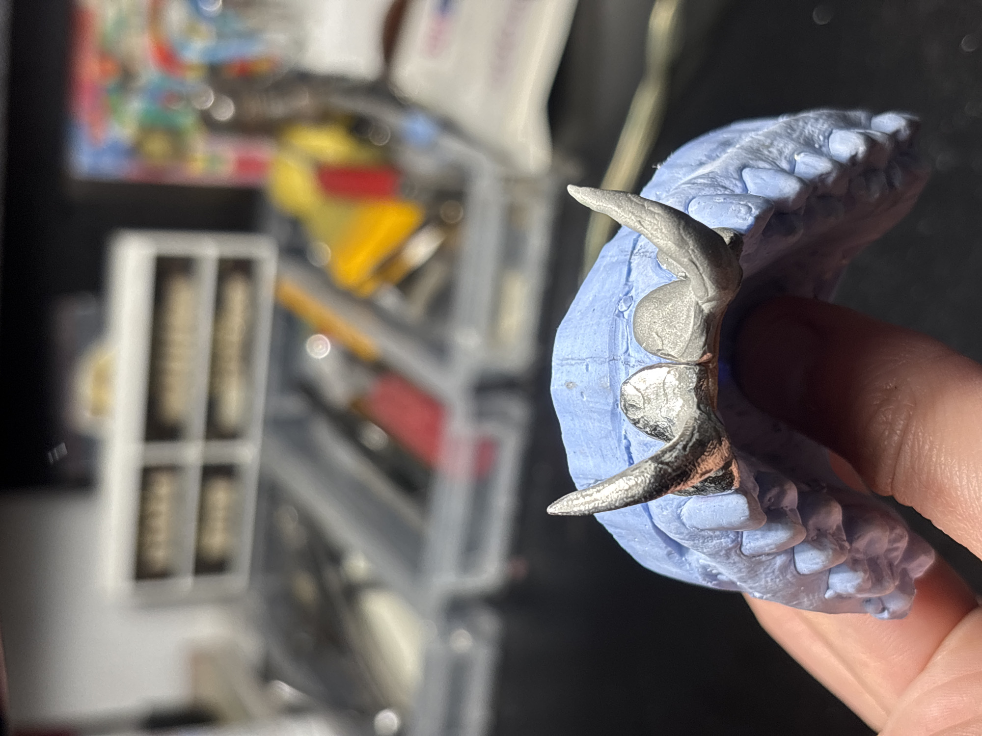 A close-up captures a dental impression held by a person's fingers. The impression is made of a light blue material, and embedded within it is a metal framework, presumably for a dental appliance. The metal structure has two distinct points, resembling teeth or prongs.
The background is blurred, revealing a collection of tools and materials, possibly related to dental work. A box with small compartments and various items in shades of yellow, silver, and red can be discerned.
Given the dental context and the presence of specialized tools, the location is likely a dental laboratory or a dentist's office. There is no information to establish the location in the city of Sofia, Bulgaria.