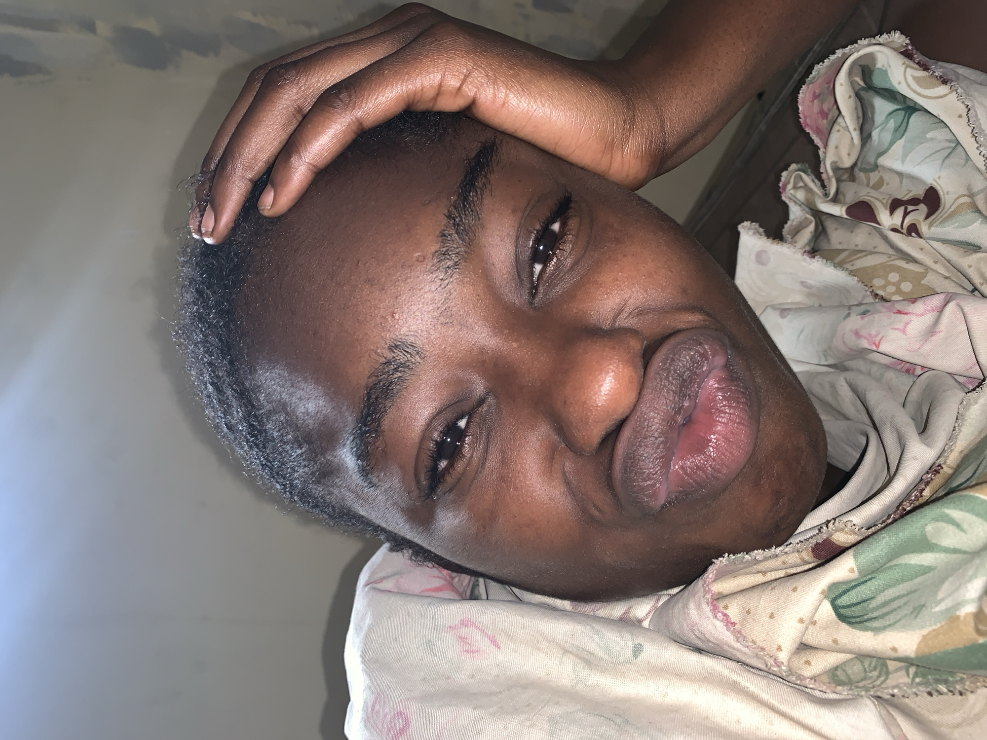 The image shows a close-up of a person with dark skin lying down. The person's hand is resting on their forehead. The person is partially covered by a floral-patterned blanket or bedding. The background is a light-colored wall. There is no information to support the location of the city of Rafin Par, Nigeria.