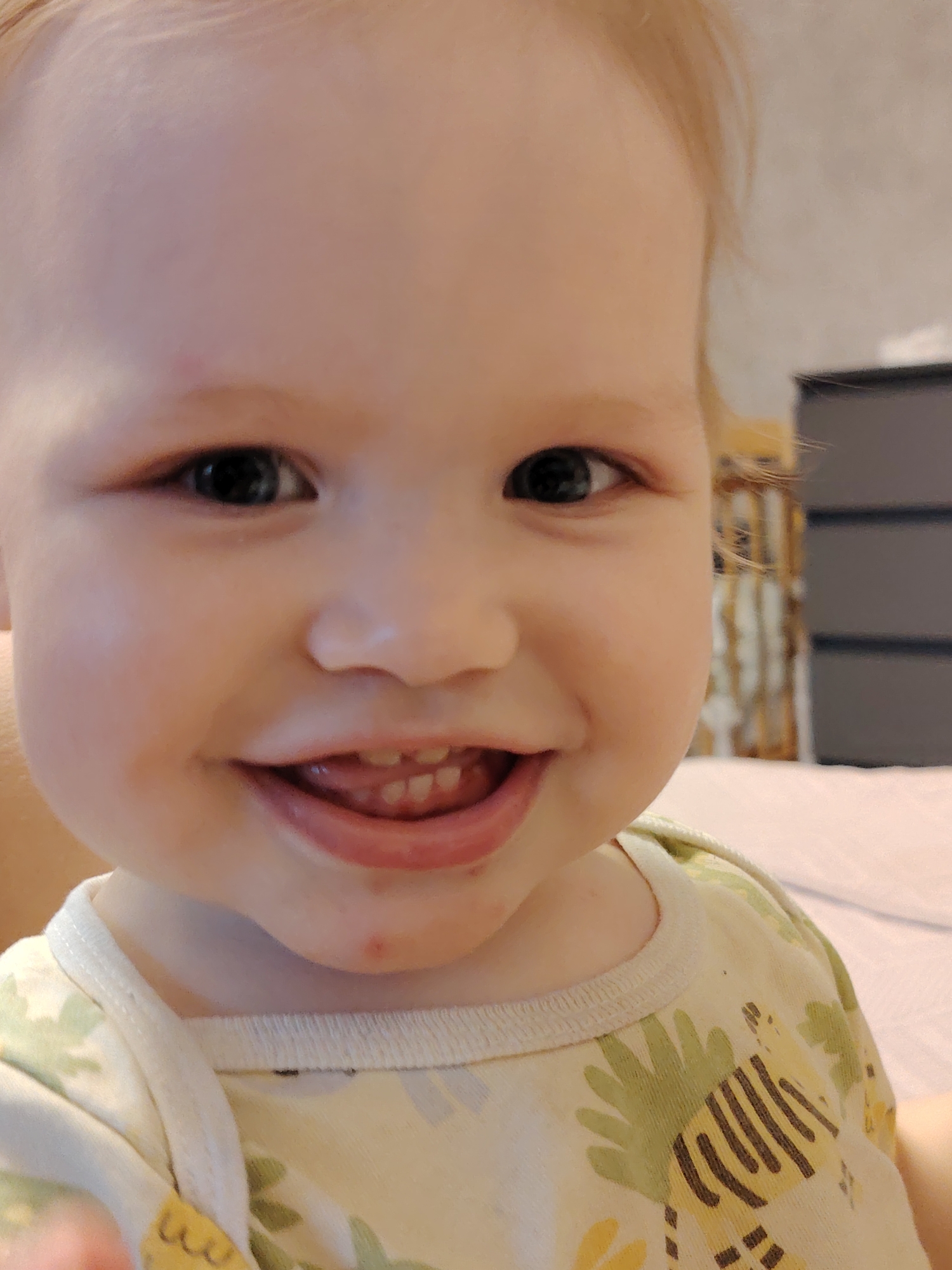 A close-up photograph depicts a baby with fair skin, dark eyes, and light blonde hair. The baby is smiling, revealing several small teeth. The baby is wearing a patterned shirt featuring green and yellow colors, with a white trim around the neckline. A small red mark is visible on the baby's forehead, and another is present on the chin. The background includes a blurred grey dresser and a neutral-colored bed or surface. There is no information available that suggests the location is in Chaikovsky, Russia.