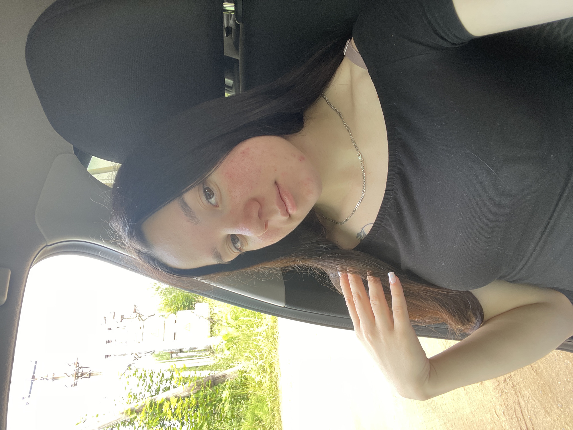 This is a portrait of a young woman, presumably taken from inside a car. She has long, dark hair and light brown eyes. Her face is turned towards the camera, and she is looking directly at it. There is some redness and what appear to be blemishes on her cheeks and forehead. She is wearing a black t-shirt and a silver necklace. Her left hand, with manicured nails, is resting on her chest, partially obscuring her arm.
The background shows a view from the car window, with greenery and what appear to be buildings or structures in the distance, suggesting an outdoor setting. The lighting is bright, indicating it is daytime, and the weather appears to be clear. The image's orientation is rotated 90 degrees counter-clockwise, with the subjects' heads to the left. There is no visible text in the image. The location context provided is Nozhovka, Russia.
