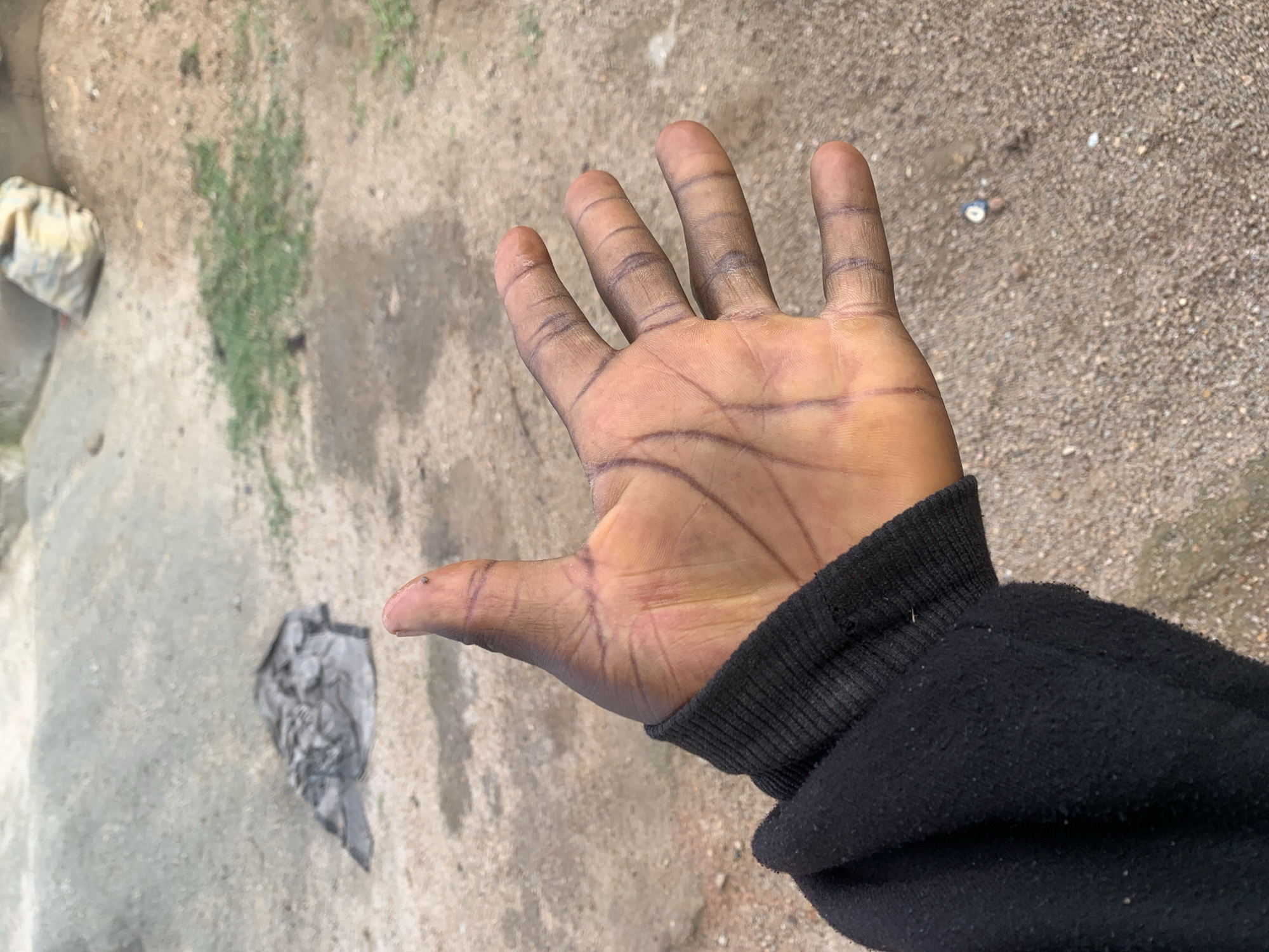 A human left hand, featuring dark skin pigmentation and visible drawn lines resembling palmistry markings and finger creases in dark ink, extends from the lower-left foreground. The hand emerges from the cuff of a black, long-sleeved garment, possibly a sweatshirt, which exhibits slight pilling. The thumb shows a small dark speck on its tip. The background depicts an unpaved outdoor environment, characteristic of a semi-urban or rural setting in Jos, Nigeria. The ground consists of light brown soil and gravel with scattered small stones. Patches of green vegetation, consistent with grass or weeds, are interspersed across the ground. In the mid-ground, a dark, crumpled object lies on the earth. Further back, to the upper right, a light-colored sack or bag rests on a mound of dirt. A small, discarded white and blue item is visible on the ground in the lower-right background. The scene is illuminated by natural daylight.