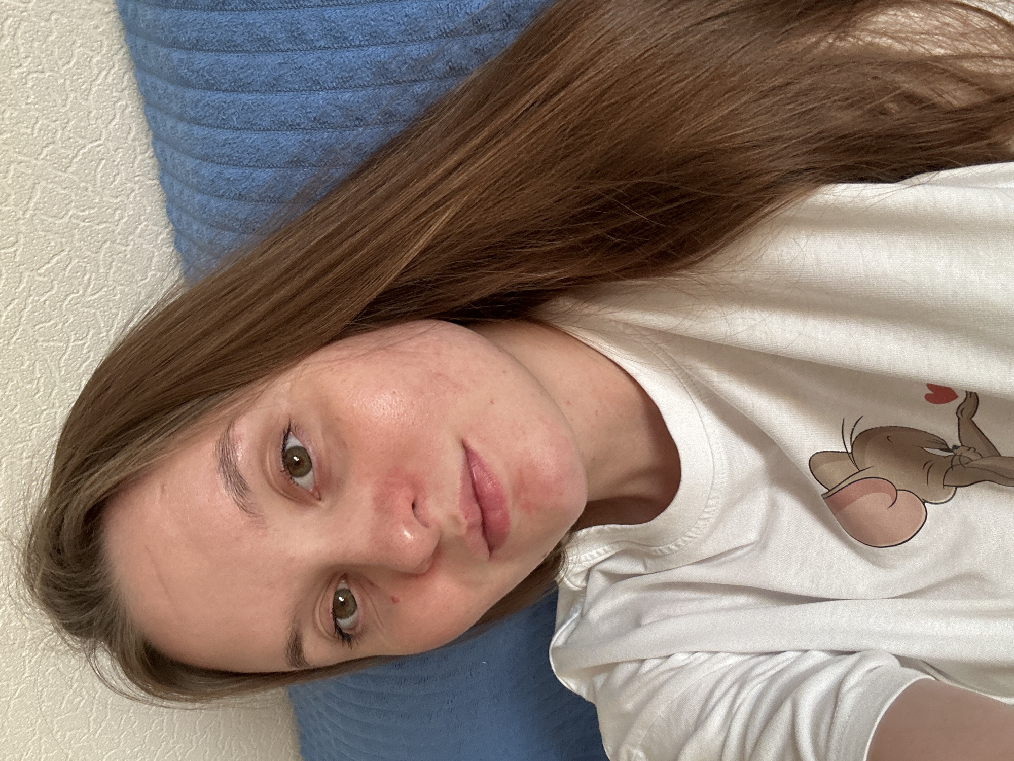 A young woman with long, brown hair and green eyes is captured in a close-up, selfie-style shot. She is wearing a white t-shirt with a cartoon character printed on it. Her skin appears flushed, particularly on her cheeks and around her nose and mouth, suggesting potential irritation or redness. She is lying down, with her head resting on a textured blue surface, possibly a couch or bed. The background is a light-colored, textured wall. The lighting appears natural, coming from the front, highlighting her features. The image was taken indoors. It is not possible to determine the location in the city of Noviy, Russia from the provided image.