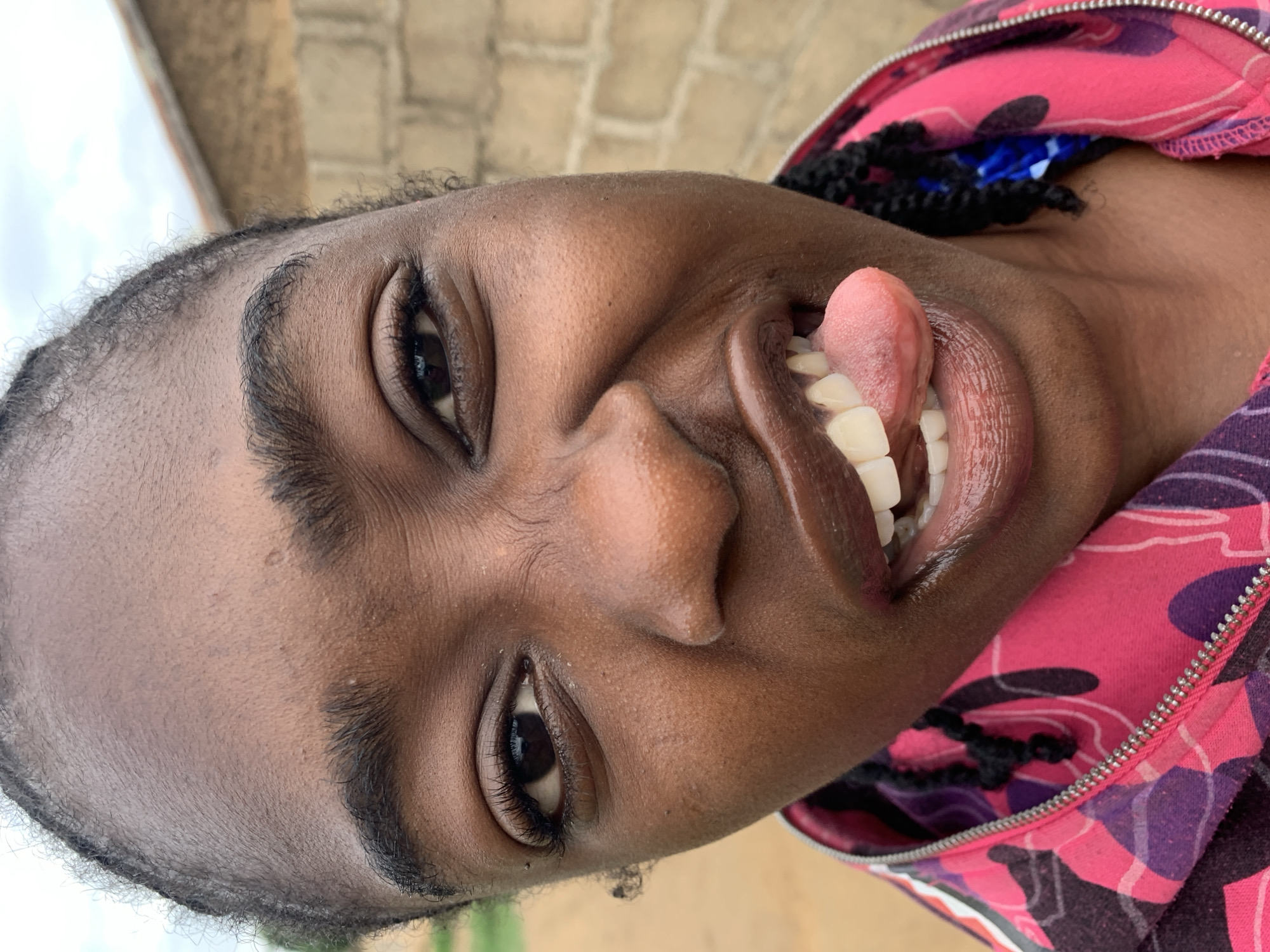 A close-up, slightly high-angle portrait shows a young individual, identified as female, with dark brown skin, looking directly at the camera. Her dark hair is braided and visible at the hairline and sides of her face. She has dark brown eyes with prominent eyelashes and dark, defined eyebrows. Her mouth is open, revealing white teeth, and her tongue is partially extended and curled towards the viewer's right. Her lips appear glossy. She is wearing a hooded jacket or sweatshirt patterned in shades of pink, purple, and black, with a silver zipper visible on the front.
The background is softly blurred. To the viewer's left, indistinct green foliage is visible under a light sky. To the viewer's right, a structure made of light-colored cinder blocks or bricks is partially visible, topped by a reddish-brown corrugated metal roof, also under a light sky. The scene is illuminated by natural light, suggesting an outdoor setting in the city of Rafin Par, Nigeria.