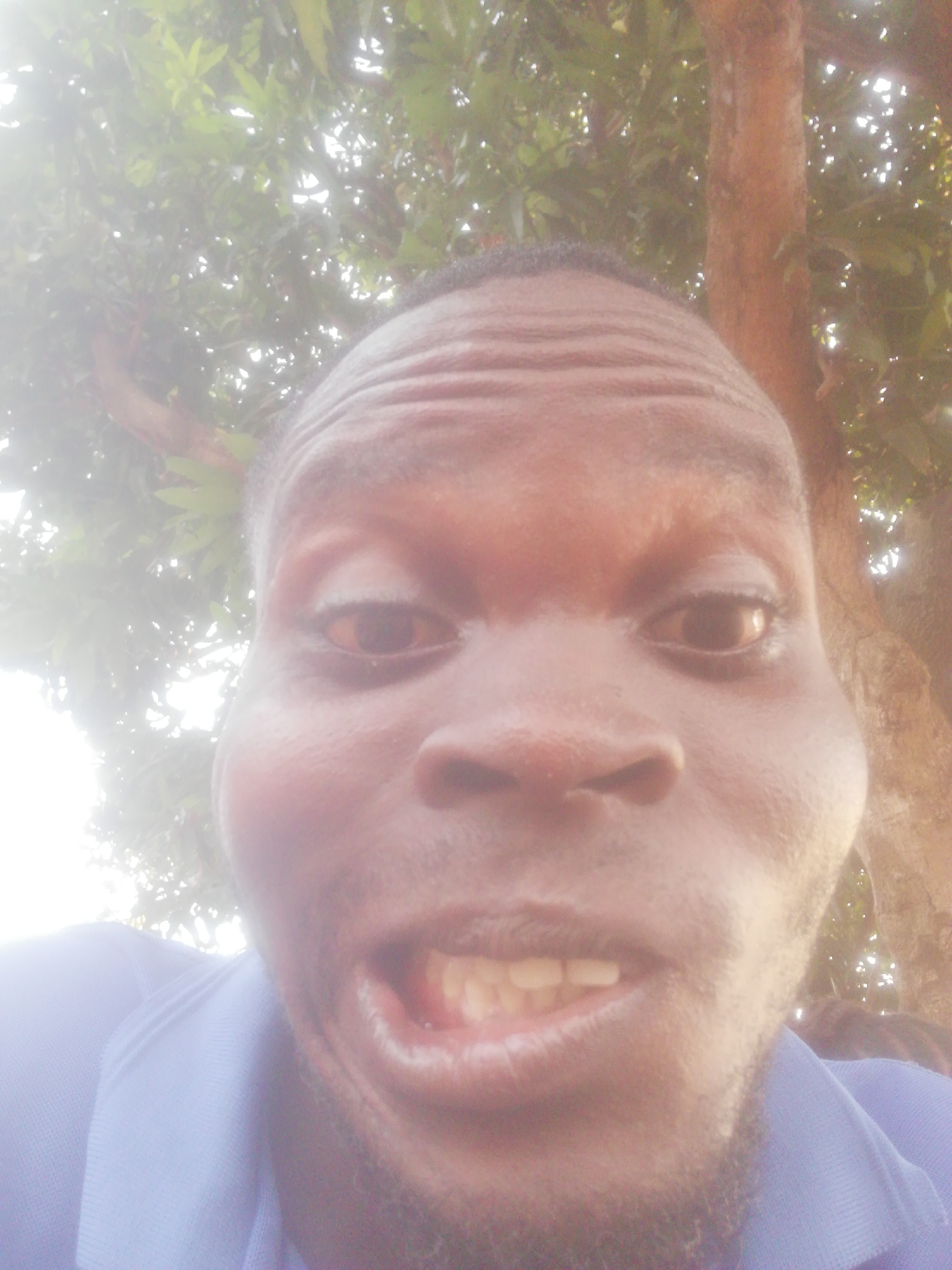 A low-angle, close-up selfie depicts a Black man outdoors, appearing to be under a tree with dense foliage and a visible tree trunk behind him. The man's face is prominent, showing features such as wrinkled forehead, dark eyes, a wide nose, facial hair, and a slightly open mouth revealing his teeth. He is wearing a blue collared shirt. The location is not discernible from the image.