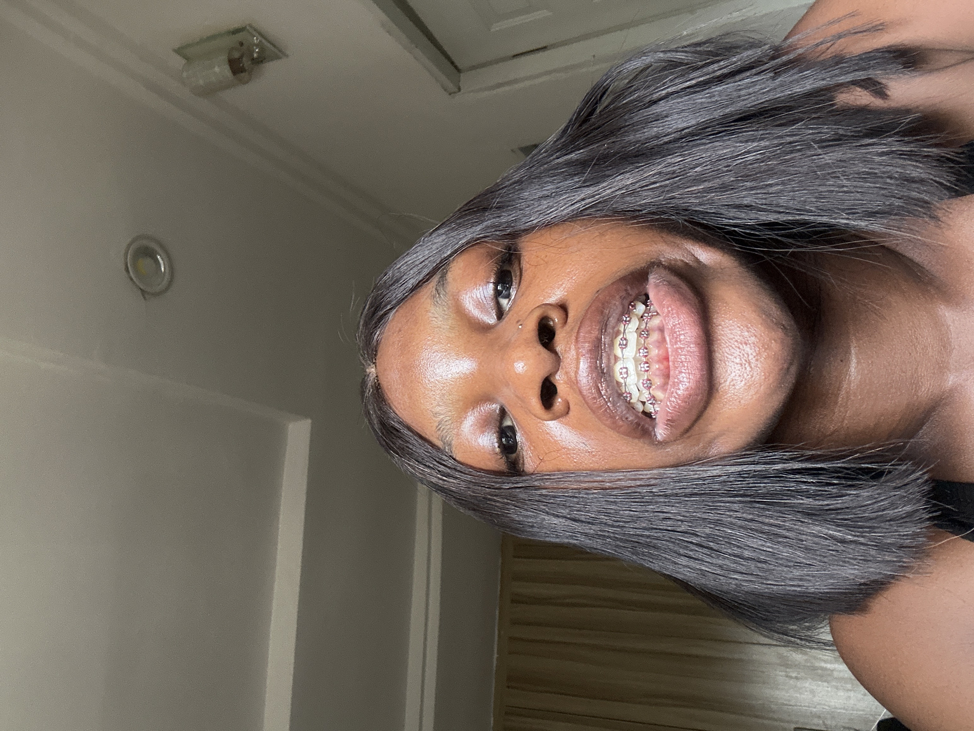 A portrait-style photograph, vertically oriented, features a young Black woman smiling broadly and looking directly upwards towards the camera. Her head is slightly tilted. She has a radiant complexion with highlights on her forehead and cheeks, and a subtle nose piercing. Her dark, straight hair, parted on one side, frames her face. She is wearing dental braces with distinct pink bands, clearly visible as she smiles, revealing her teeth and gums.
The background is an indoor ceiling and wall, primarily in light, neutral tones. Two light fixtures are visible on the ceiling: a circular recessed light and a rectangular fixture with an exposed, fluorescent-style bulb. In the lower right corner, behind the woman's shoulder, part of a light brown or beige door with horizontal slats is visible. The lighting is bright and overhead. The woman's expression conveys happiness and cheerfulness. The scene depicts a casual indoor setting in Abuja, Nigeria. No visible text is present.