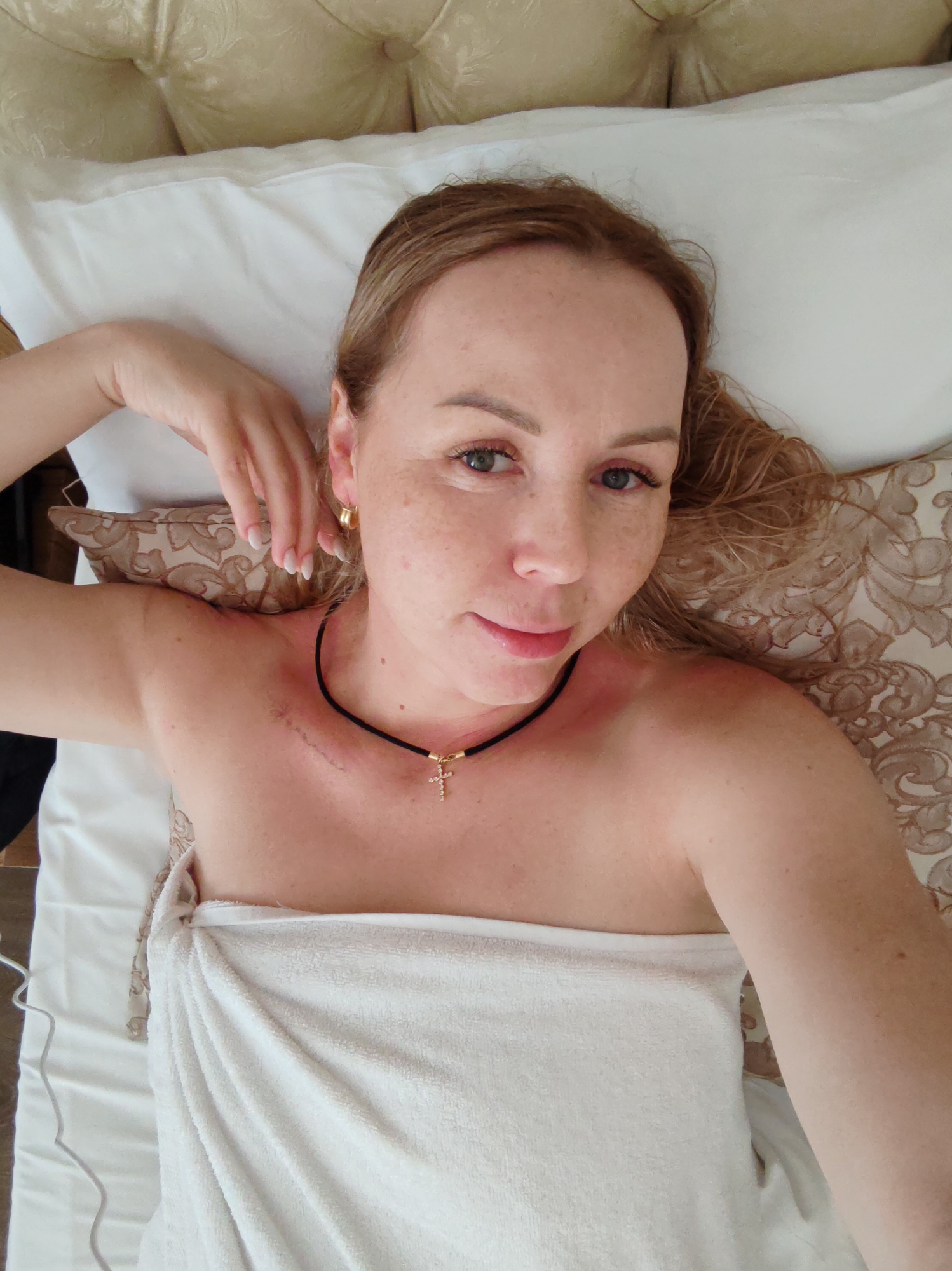 A fair-skinned woman with light brown hair lies on a bed. She is partially covered with a white towel. She wears a black cord necklace with a gold cross pendant and gold hoop earrings. A visible scar extends across her upper chest and shoulder. She is lying on a white pillow with a decorative brown pillow behind her head. The location is Alanya, Turkey.