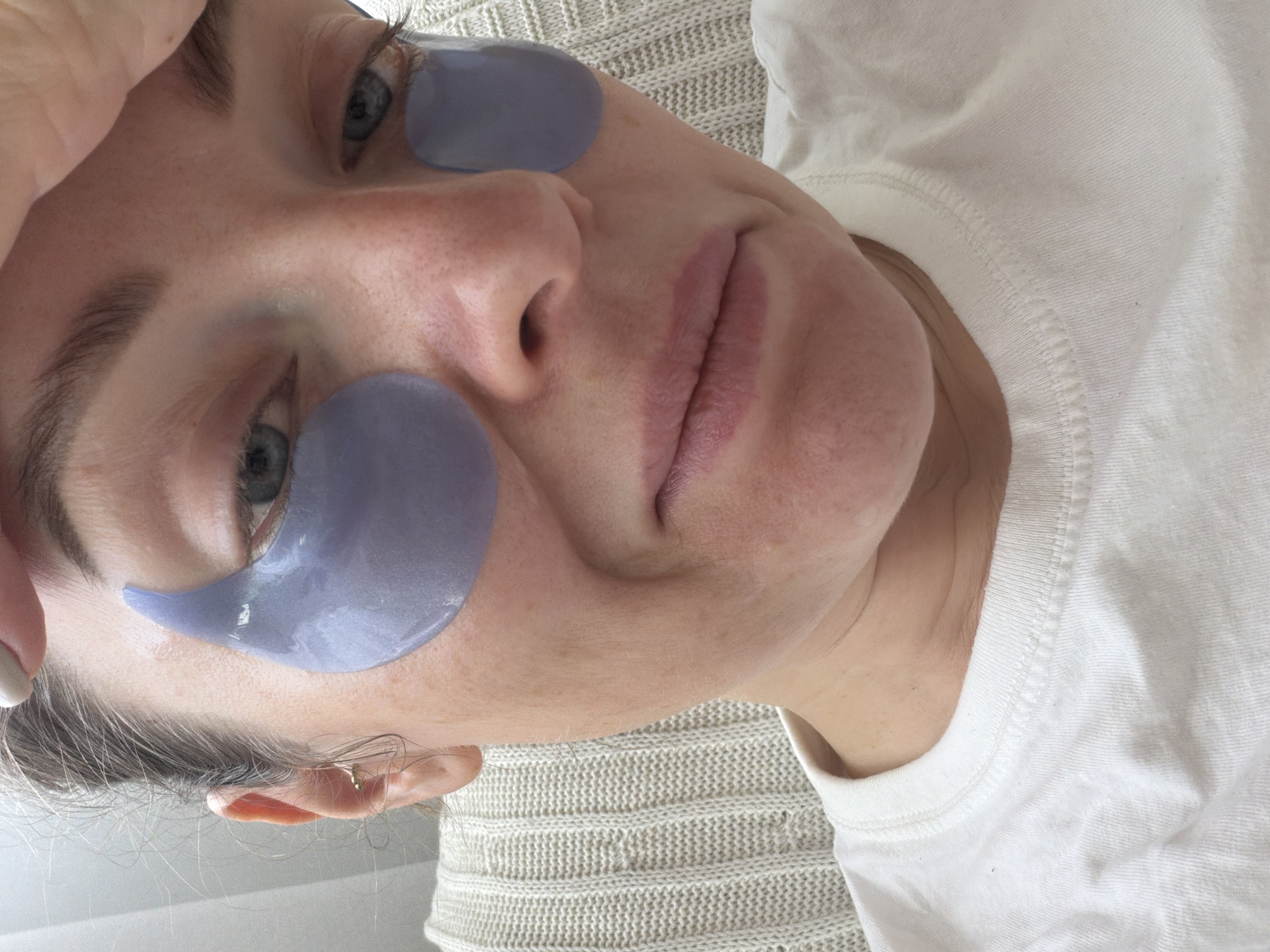 A close-up, slightly rotated, selfie-style photograph features a fair-skinned person wearing purple under-eye patches. The person has light-colored eyes and visible eyebrows, with freckles on the nose. Their lips are lightly colored. They are wearing a white t-shirt. The background is a textured, off-white surface, possibly a knitted blanket or sweater. There is no clear indication of Moscow, Russia in the image.