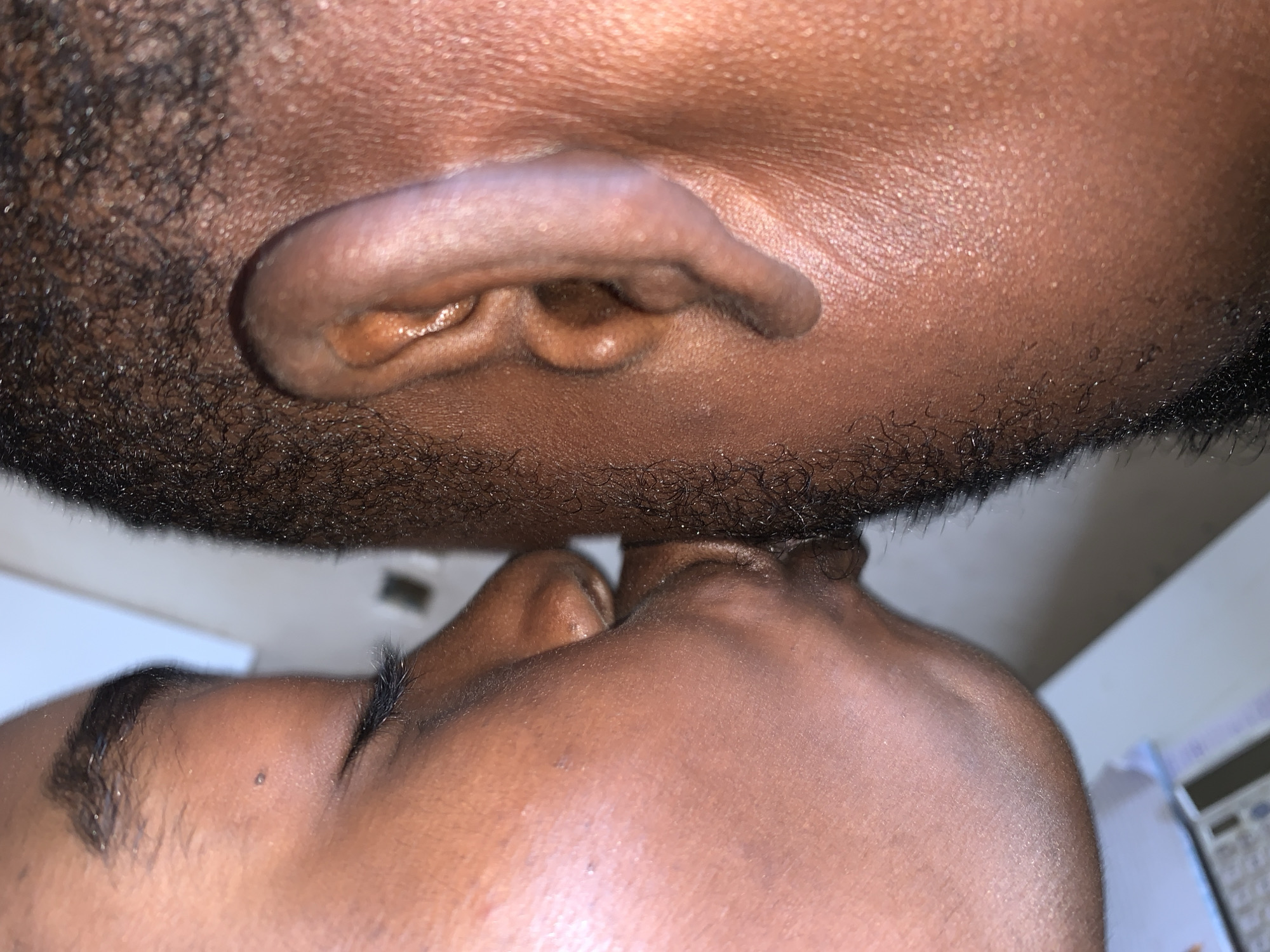 Located in New Stadium, Nigeria, the image presents a close-up, vertical view of two individuals in an intimate interaction. The person on the left, exhibiting dark skin, has their eye closed, revealing dark eyelashes and a small mole superior to the eye. Their nose and lips are pressed firmly against the cheek and lower ear region of the individual on the right. The person on the right, also with dark skin, is depicted in profile, showcasing a short, dark hairstyle, a prominent ear, and a noticeable growth of short facial hair along their cheek and jawline. The background is out of focus, suggesting an indoor environment with indistinct light-colored surfaces and what appears to be a desk or counter with an electronic device in the lower left.