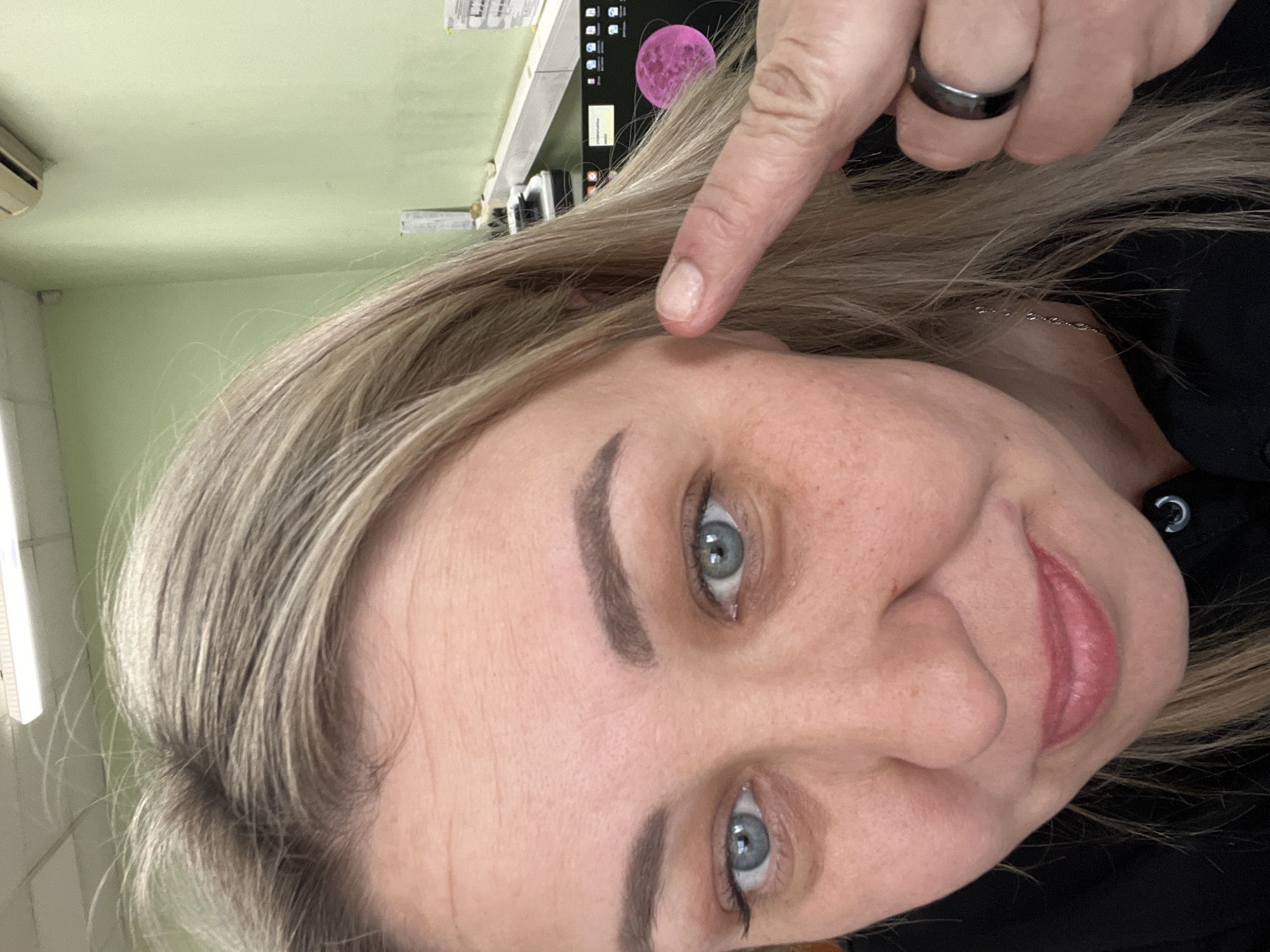 A selfie shows a woman pointing at a mole on her face. She has blonde hair and blue eyes. She wears a dark ring on her index finger. The background is a light green wall and a computer screen with a pink lunar image. The location is not discernible as Chaikovsky, Russia, from the image.