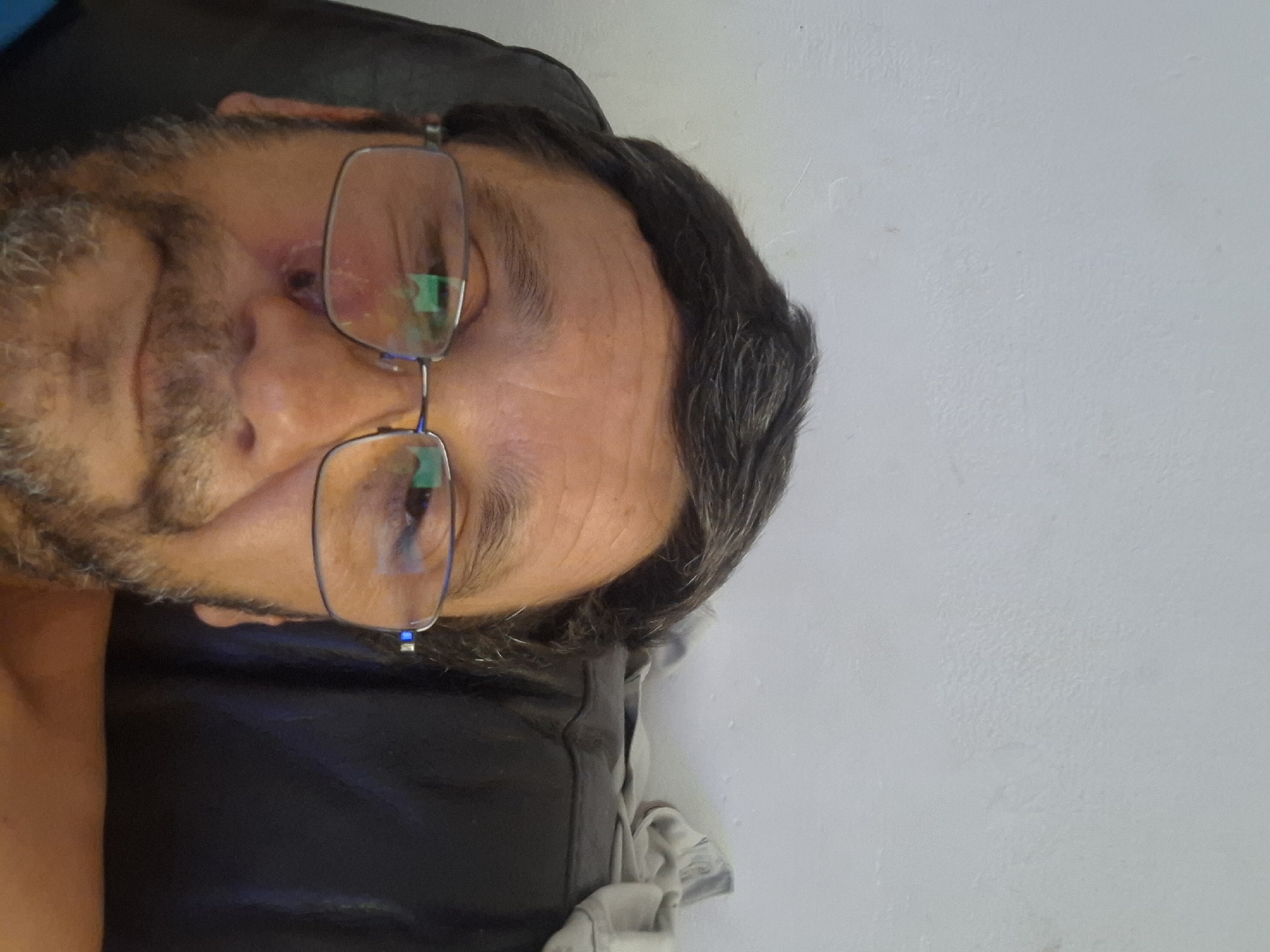 The image is a close-up selfie of a man wearing glasses. He has dark hair and a beard. There appears to be a bruise or wound on his left cheekbone. He is indoors, with a white wall behind him and what appears to be a dark upholstered chair he is sitting in. The image is not sufficient to determine its location in Yerocham, Israel.