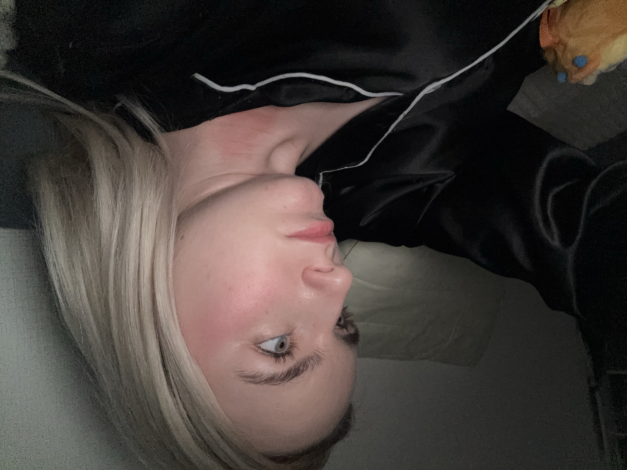 The image features a close-up of a young person lying down, oriented horizontally within the frame. The subject has blonde hair, fair skin, and light blue eyes that are open and looking towards the right side of the image. A distinct reddish mark or rash is visible on their neck, extending towards the jawline. Their lips are slightly parted, and their expression appears neutral or contemplative.
The person is wearing a black garment, likely pajamas, which has a satin-like sheen and white piping along the collar or lapel. The background is dark and indistinct, suggesting an indoor setting such as a bedroom, under dim lighting conditions. In the upper right corner, a blurry object with orange, yellow, and blue elements, possibly a plush toy, is partially visible. The low light levels suggest either nighttime or a dimly lit interior. There are no specific activities depicted other than the person resting. No text is visible in the image, and there are no specific visual cues to confirm the Vsevolozhsk, Russia location context.
