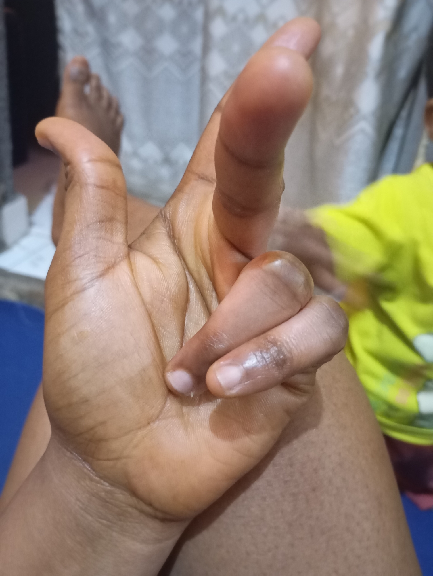 A close-up shot focuses on a person's left hand, fingers slightly curled and extended. The hand appears to be resting on the person's thigh, visible in the lower half of the frame, with the skin exhibiting a warm, brown tone and visible pores. To the upper left, a bare foot with toes is also visible. In the background, a textured white curtain and a portion of a person wearing a bright yellow shirt are out of focus. The scene is dimly lit, suggesting an indoor setting in what could be New Stadium, Nigeria.
