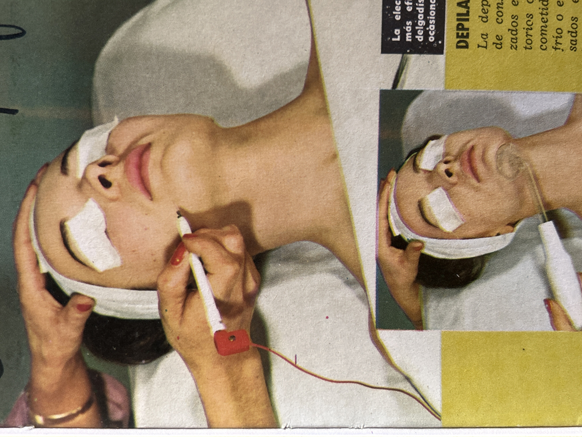 The image shows a close-up of a woman's face undergoing a cosmetic facial treatment. She is lying down, and her eyes are covered with white pads. A person's hands are visible, one holding a white, pen-like instrument with a red connector, and the other gently touching her temple. A thin red wire extends from the connector. The background appears to be a light-colored surface, possibly a treatment table. A smaller inset image below shows another person's hands holding a similar white instrument near a woman's face, also with eye pads. Text in Spanish is visible on the right side of the image, with the heading "DEPILA" and other words related to hair removal or cosmetic procedures. The scene depicts a beauty treatment session. There is no information in the image to suggest a specific location in Santa Ana, Venezuela.